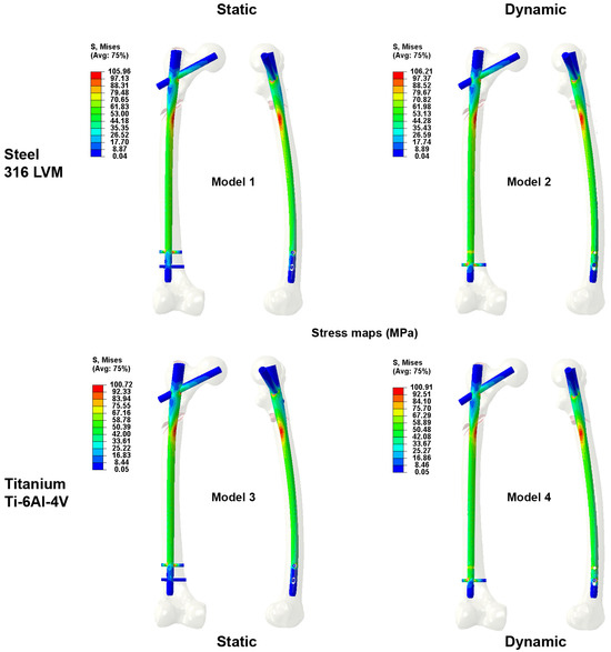Expert Tibia Nailing System - Madison Ortho by andrewrodrigues110822 - Issuu