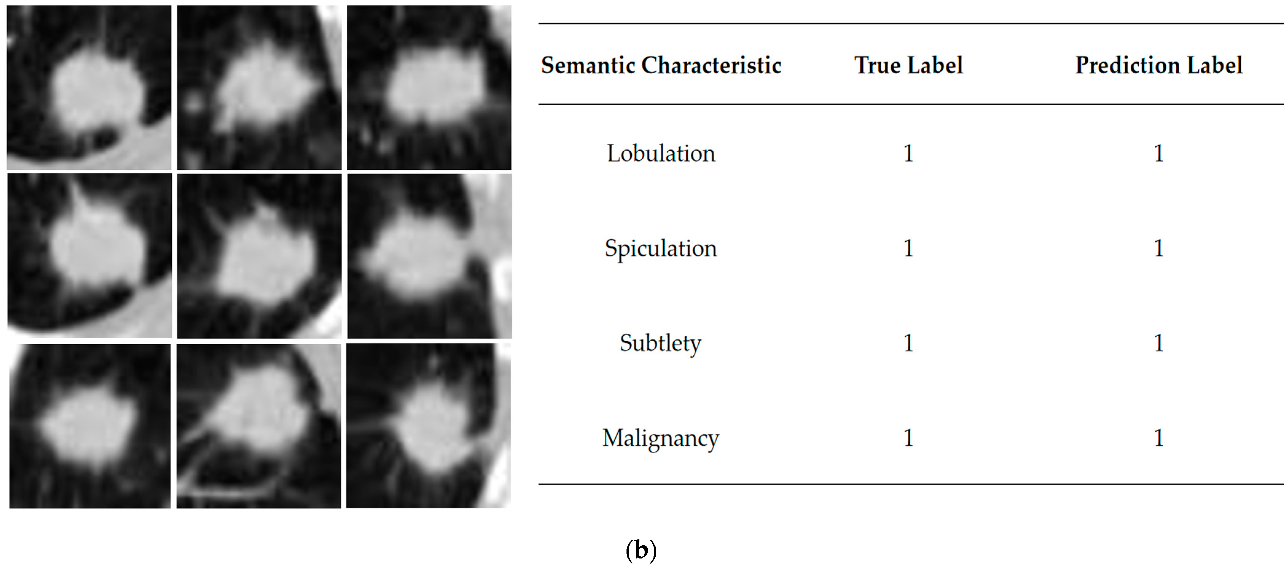 Bioengineering 10 01245 g006b