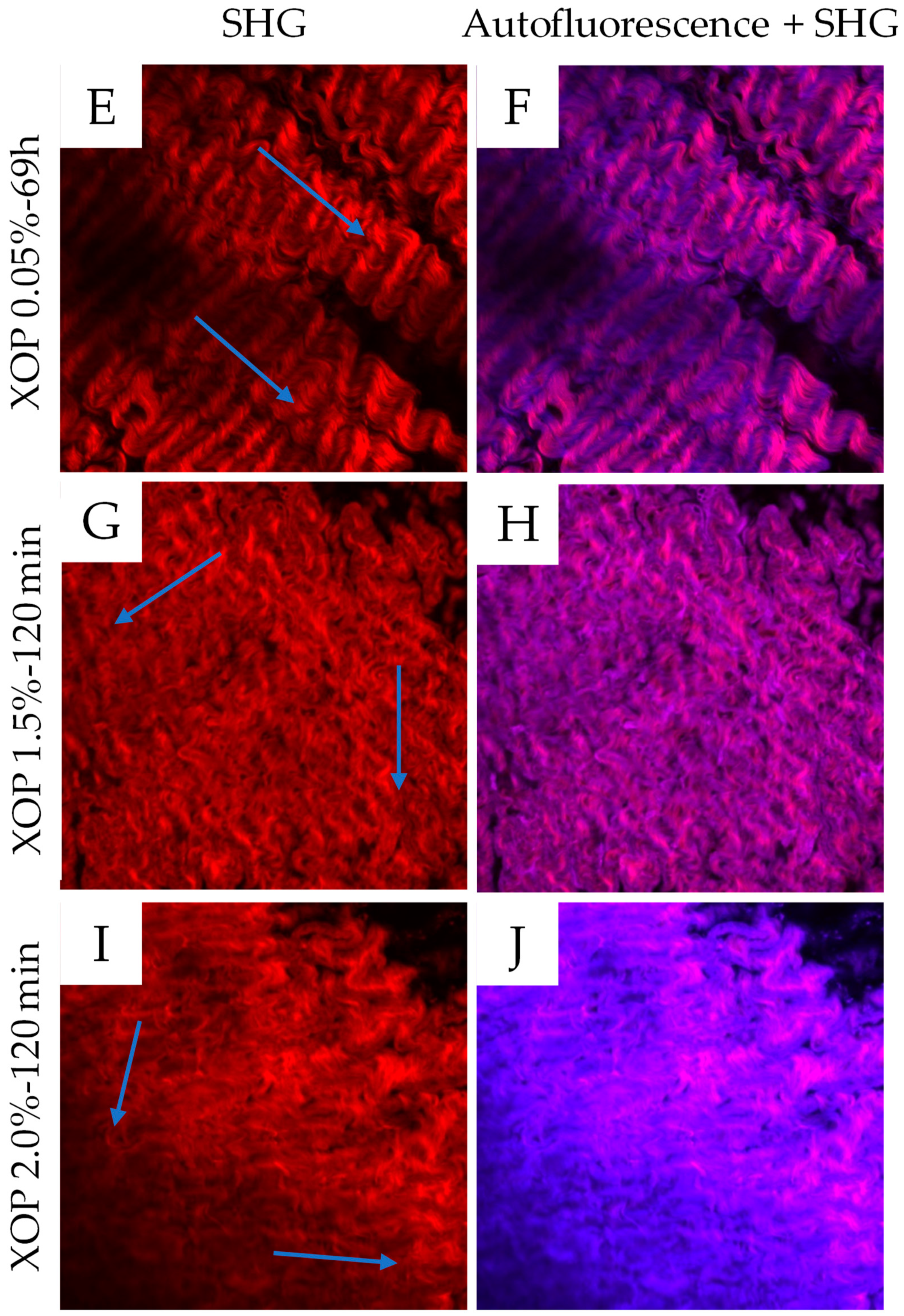 Bioengineering 10 01247 g006b