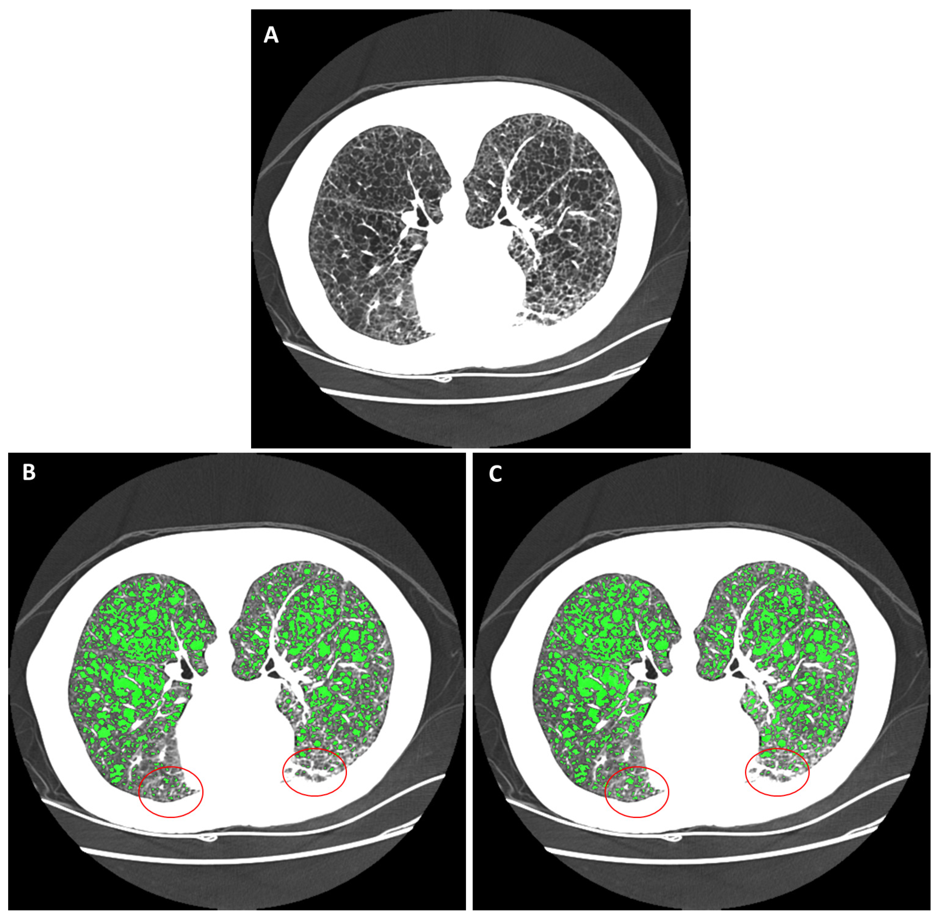 Bioengineering 10 01255 g005