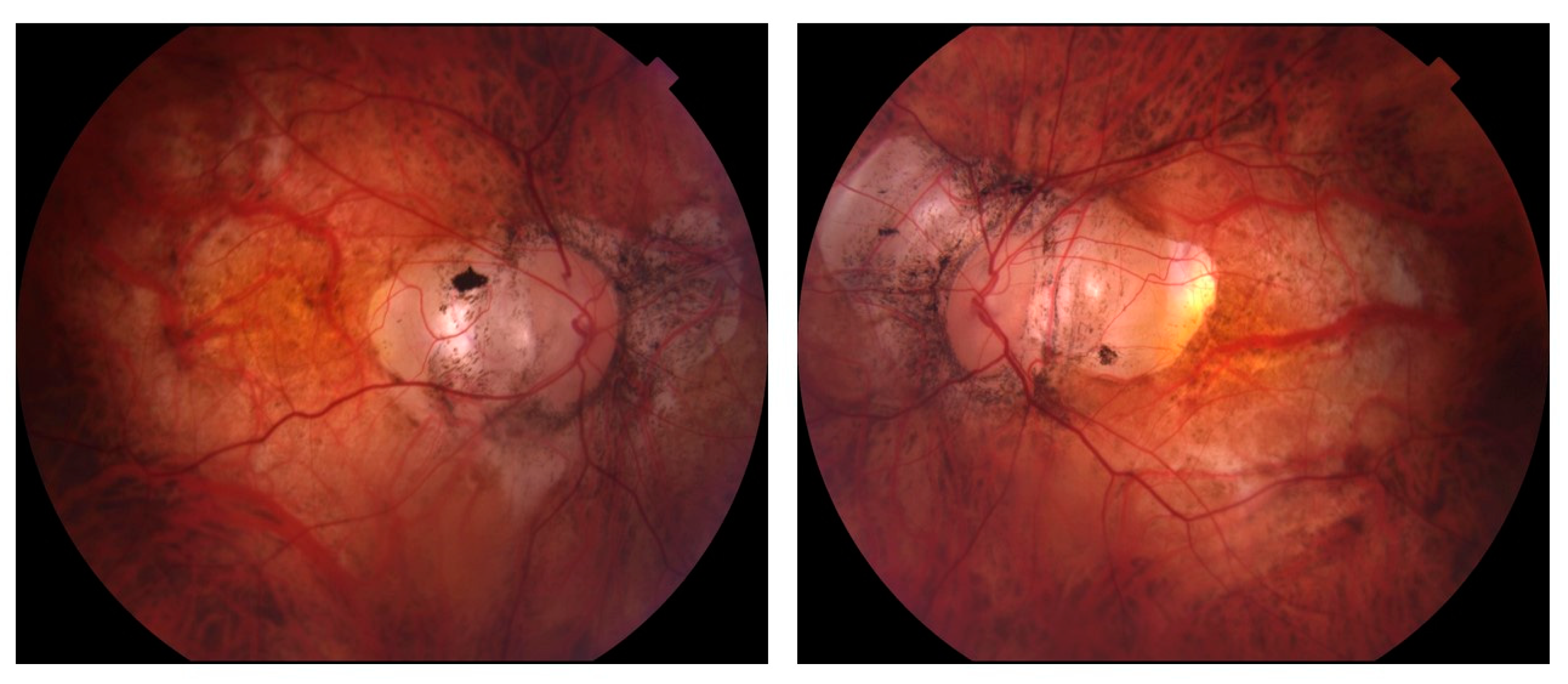 Bioengineering 10 01260 g002
