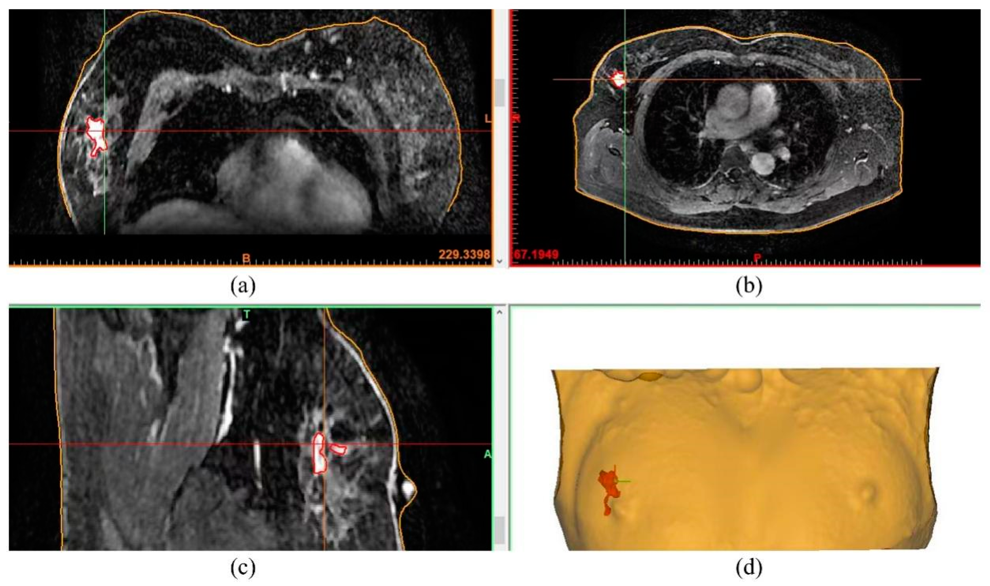 Bioengineering 10 01296 g001