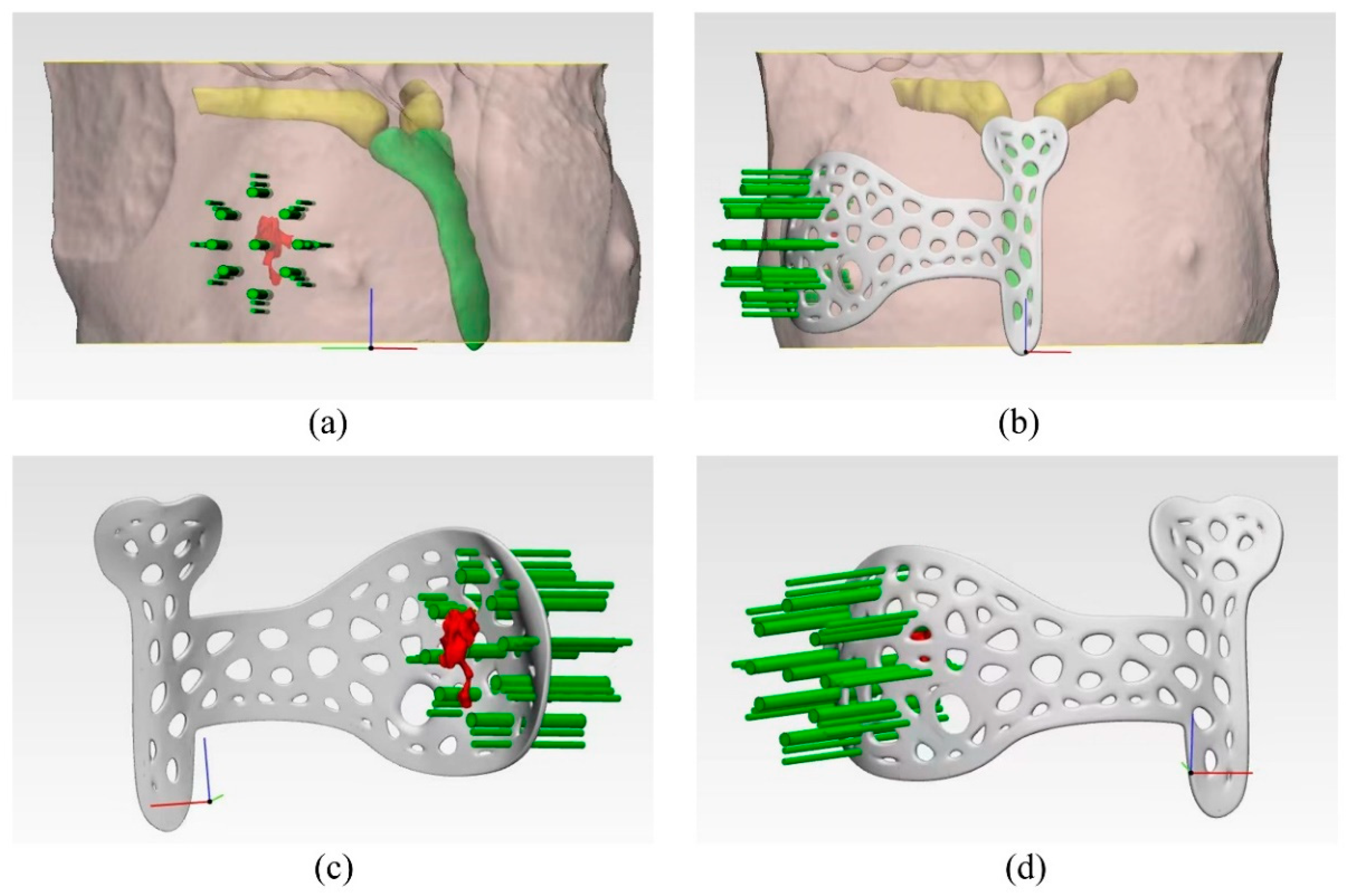 Bioengineering 10 01296 g002