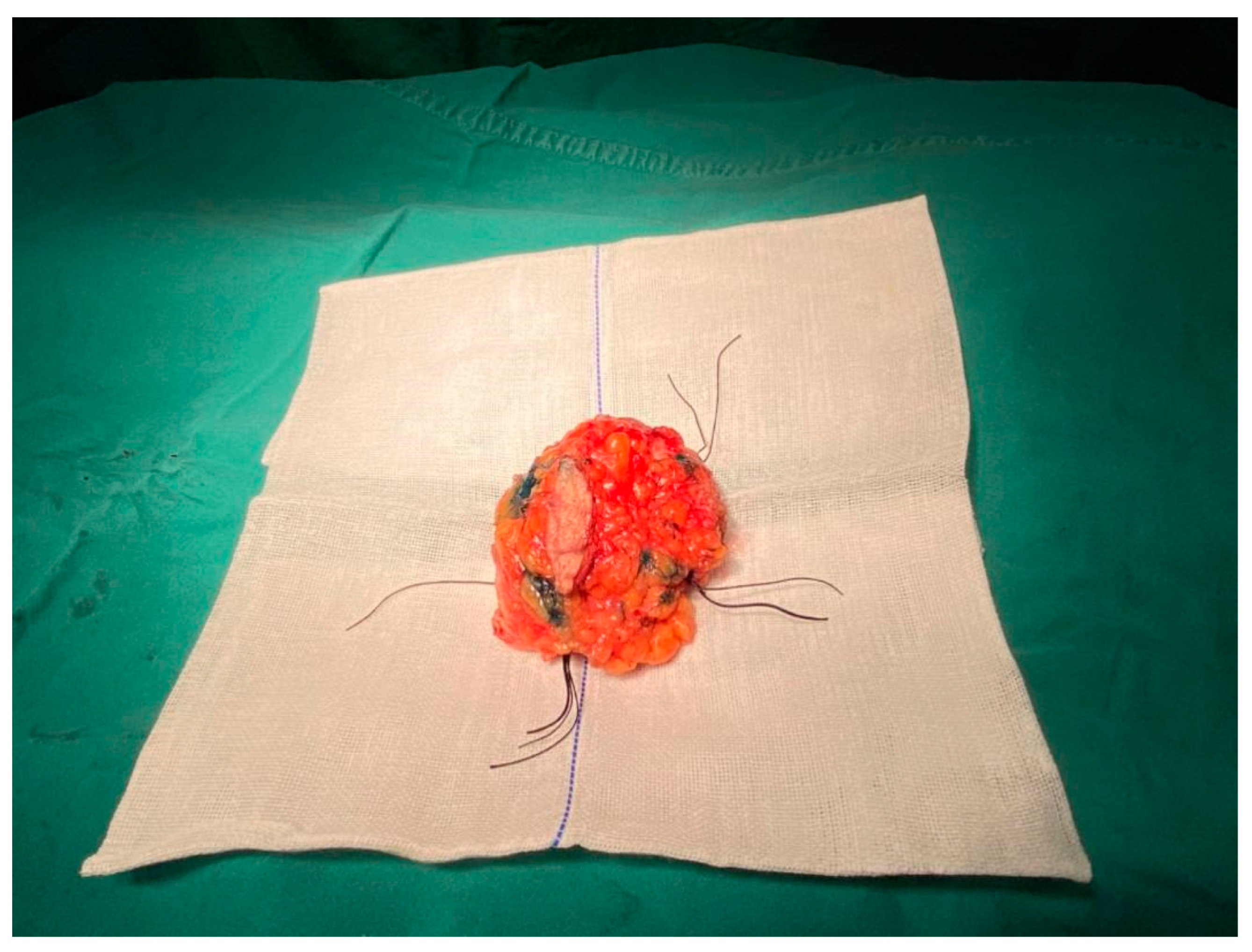 Bioengineering 10 01296 g005