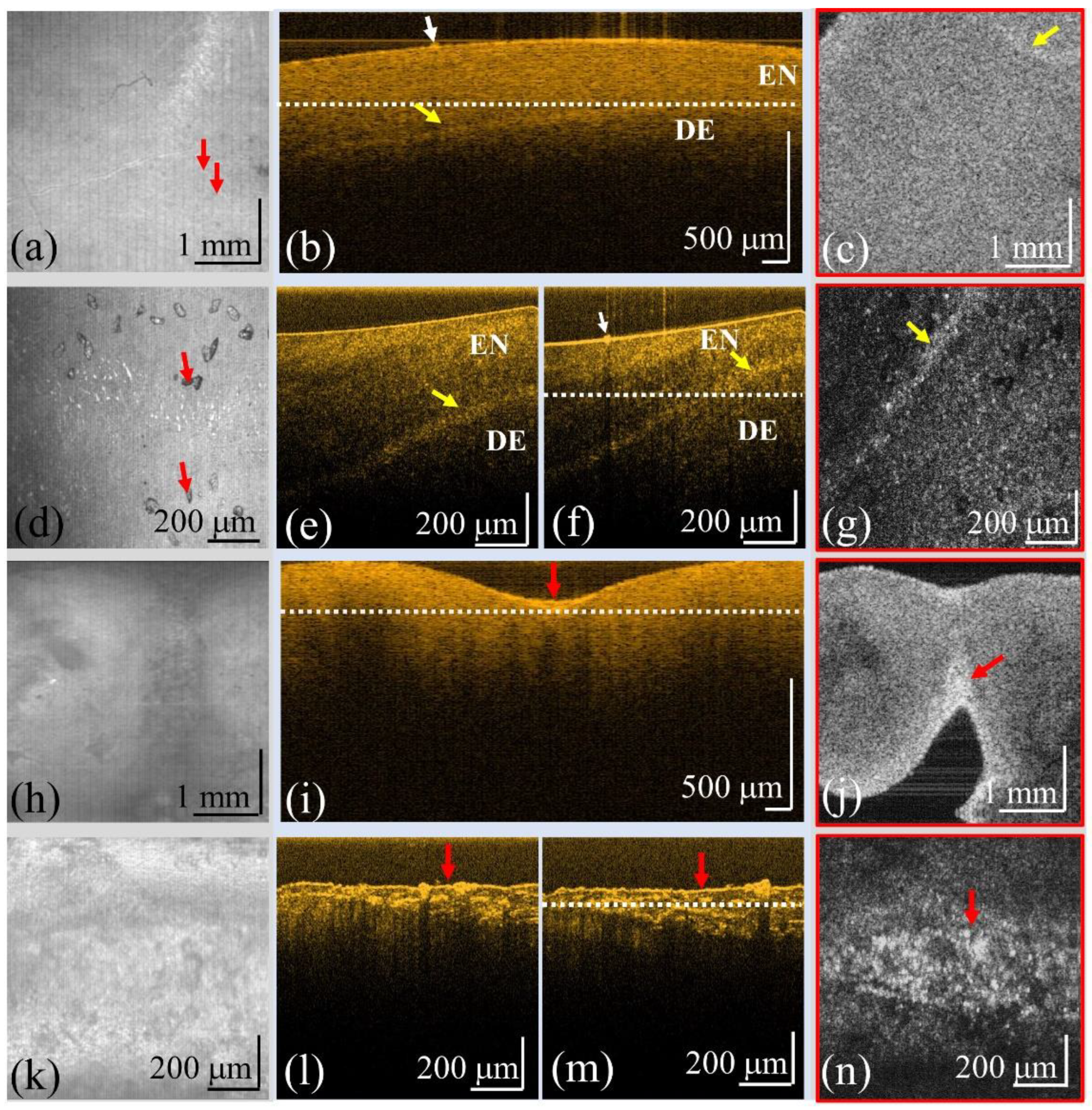 Bioengineering 10 01317 g004