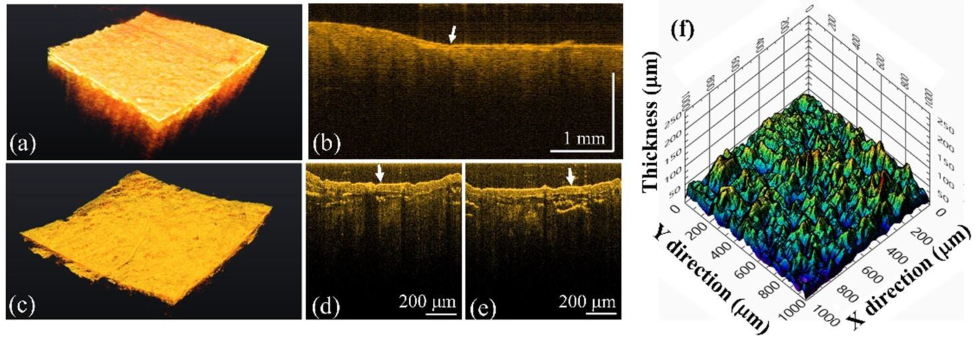 Bioengineering 10 01317 g008
