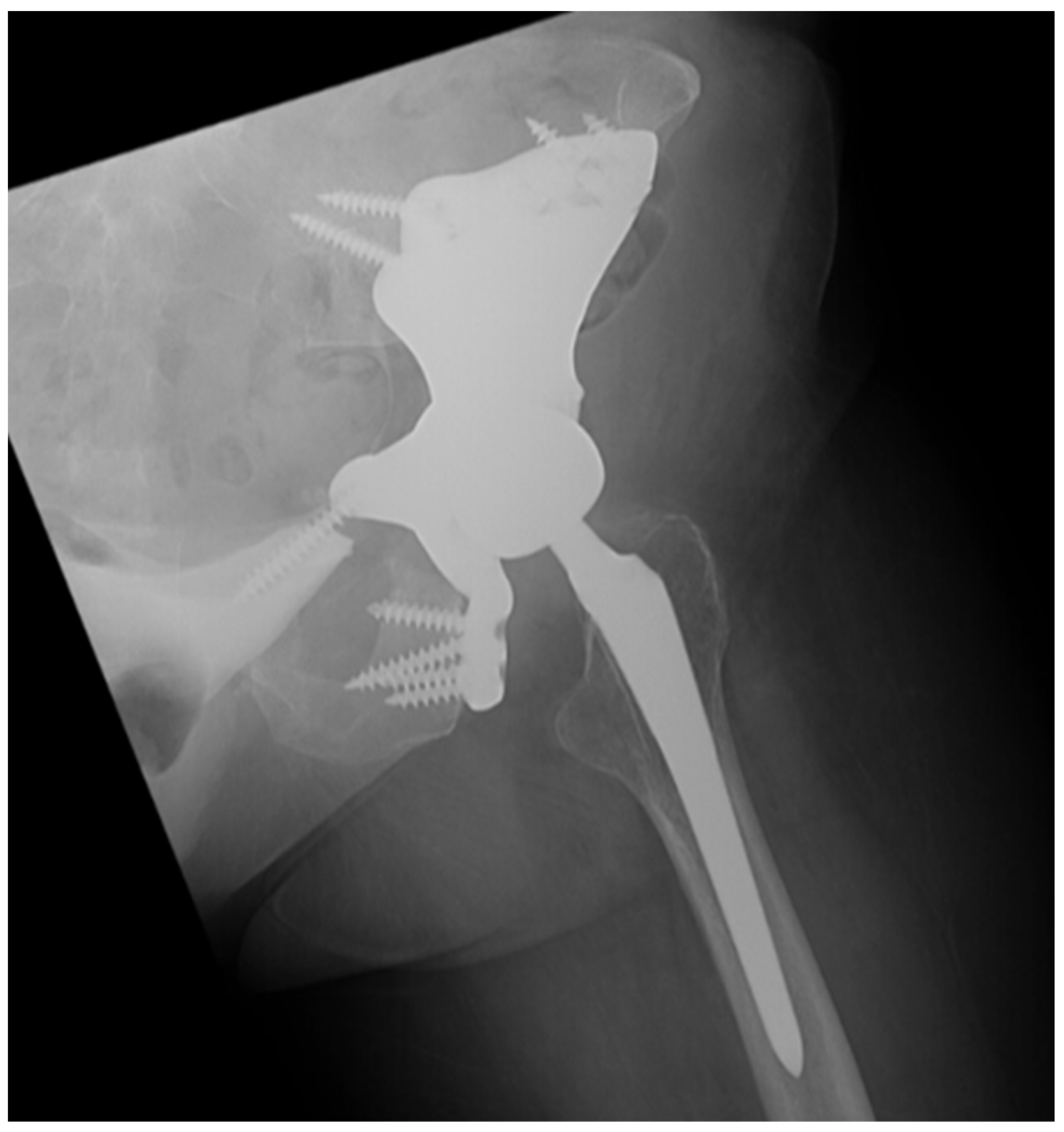 Bioengineering 10 01342 g005