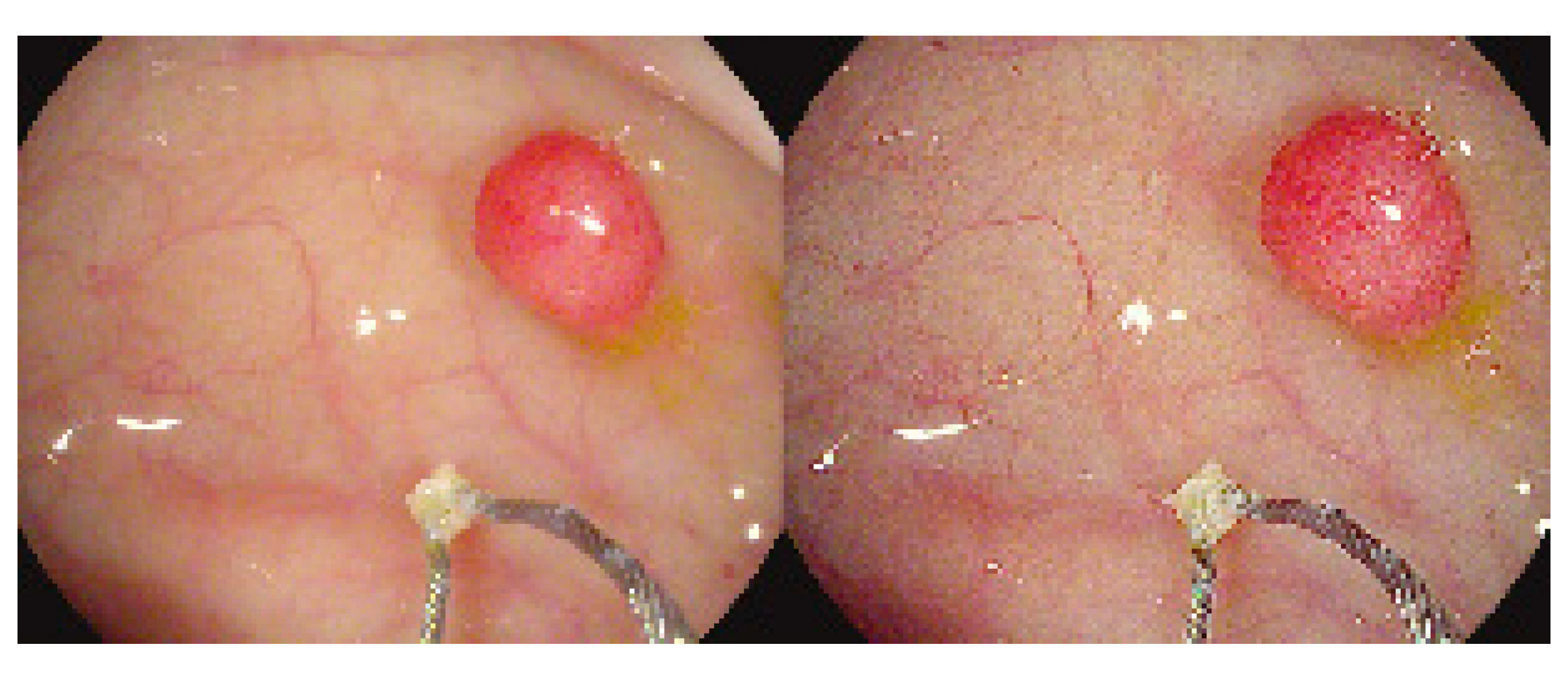 Bioengineering 10 01347 g013