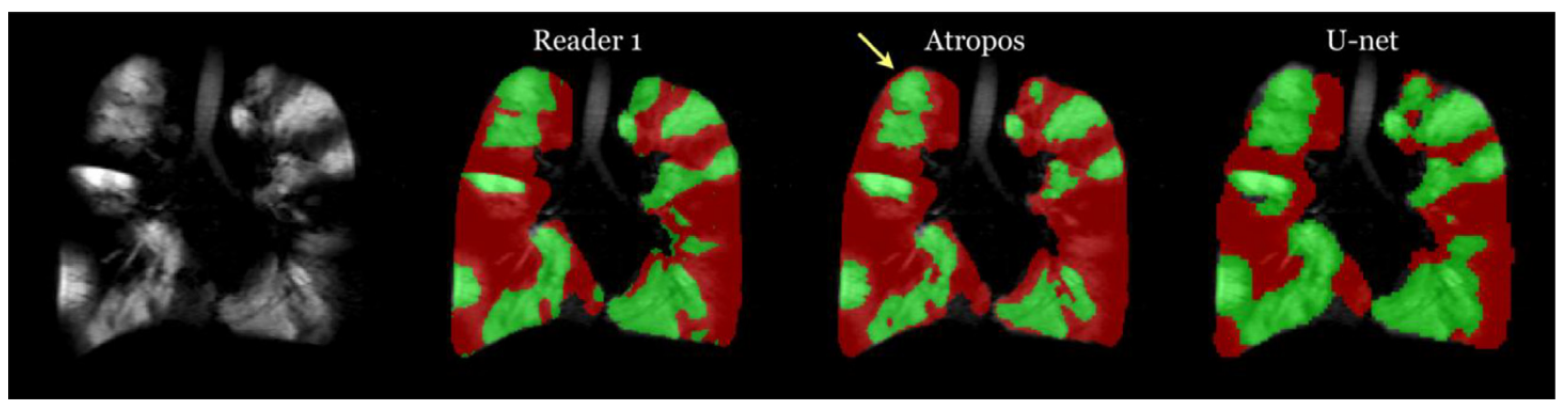 Bioengineering 10 01349 g015