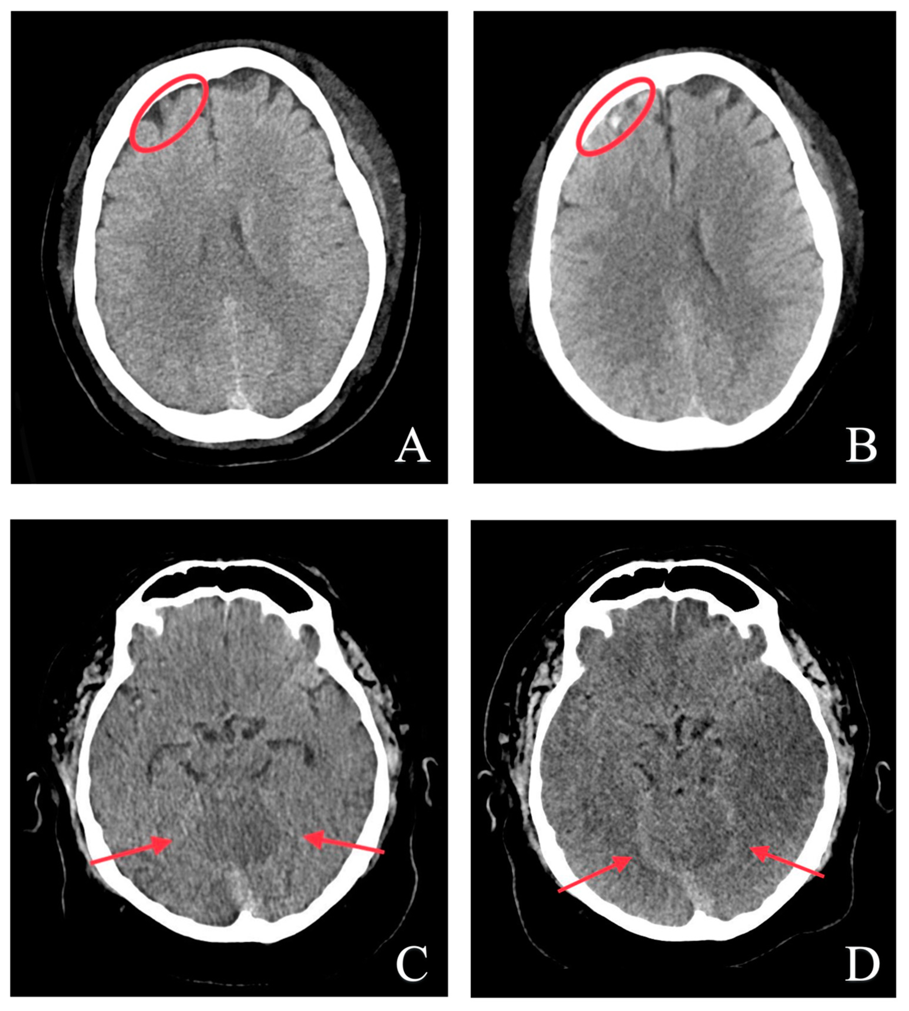 Bioengineering 10 01362 g004