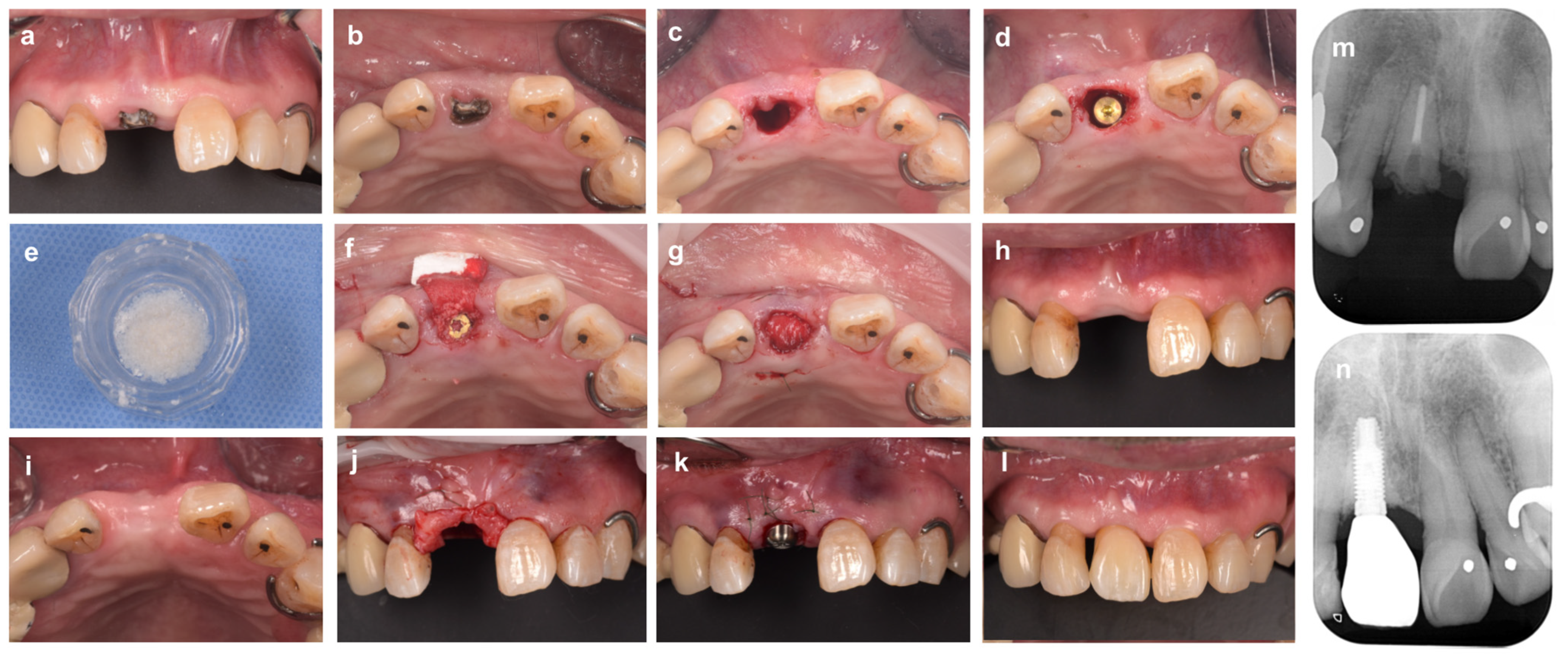 Bioengineering 10 01376 g002