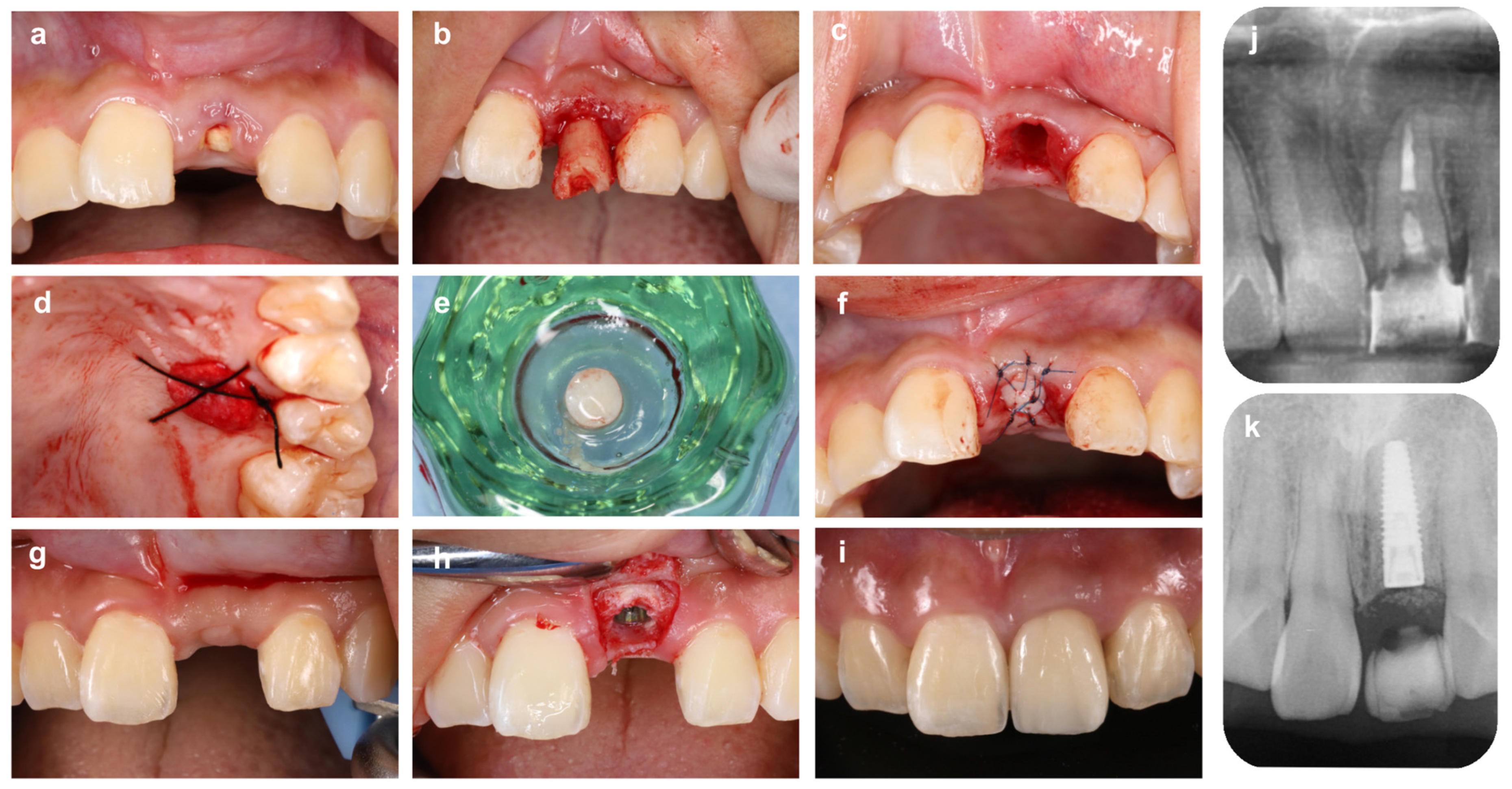Bioengineering 10 01376 g003