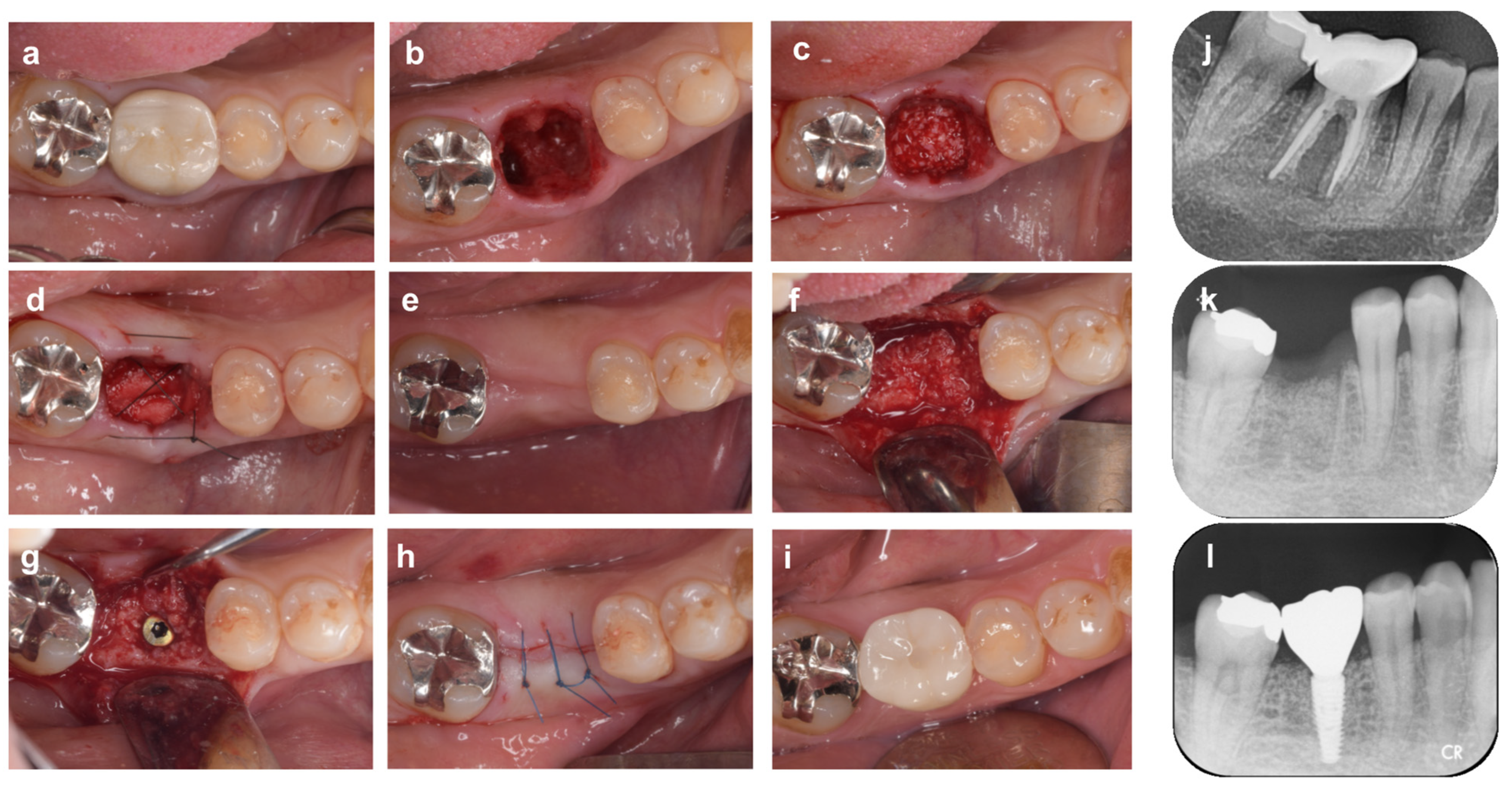 Bioengineering 10 01376 g004