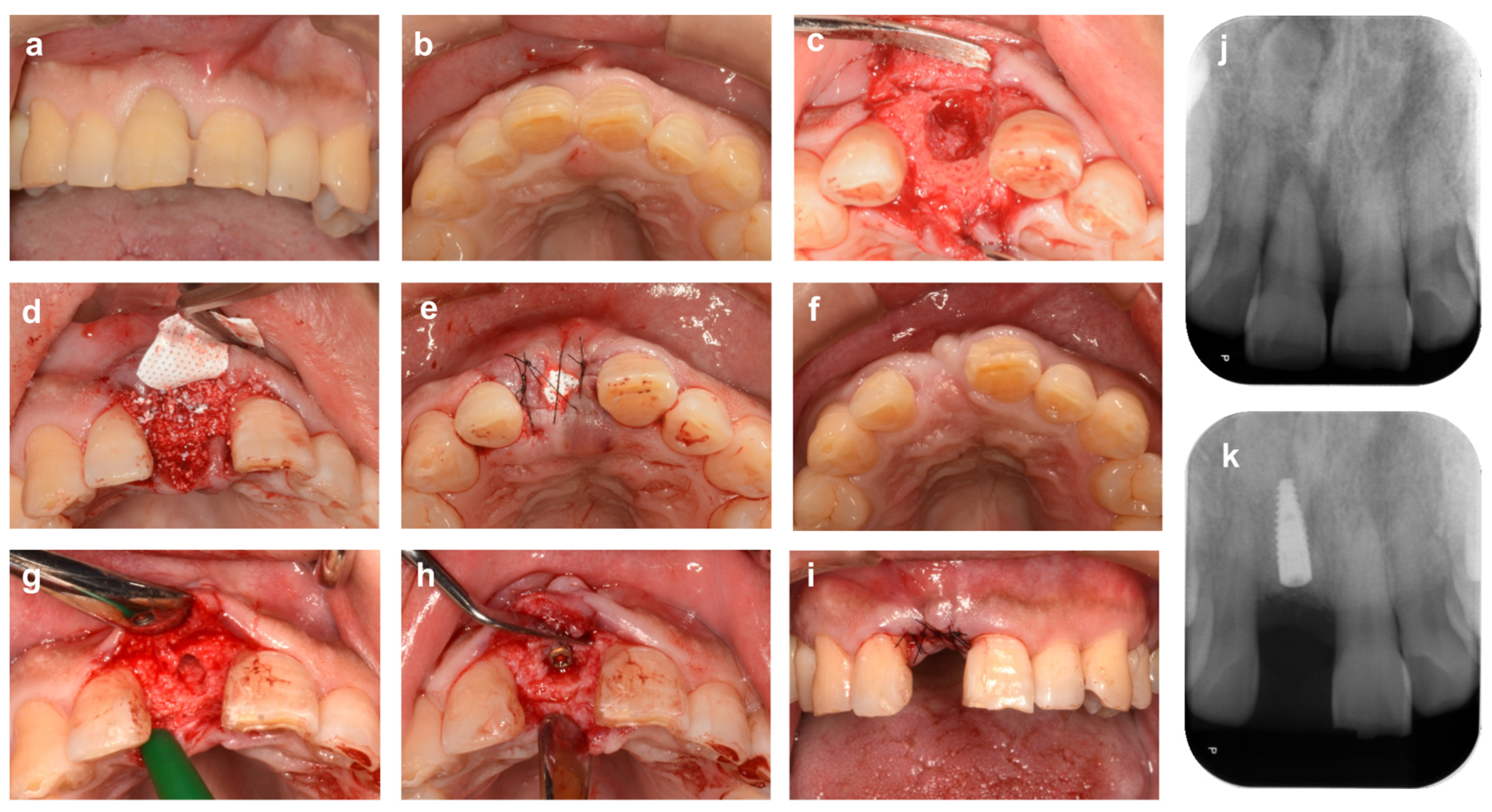 Bioengineering 10 01376 g007
