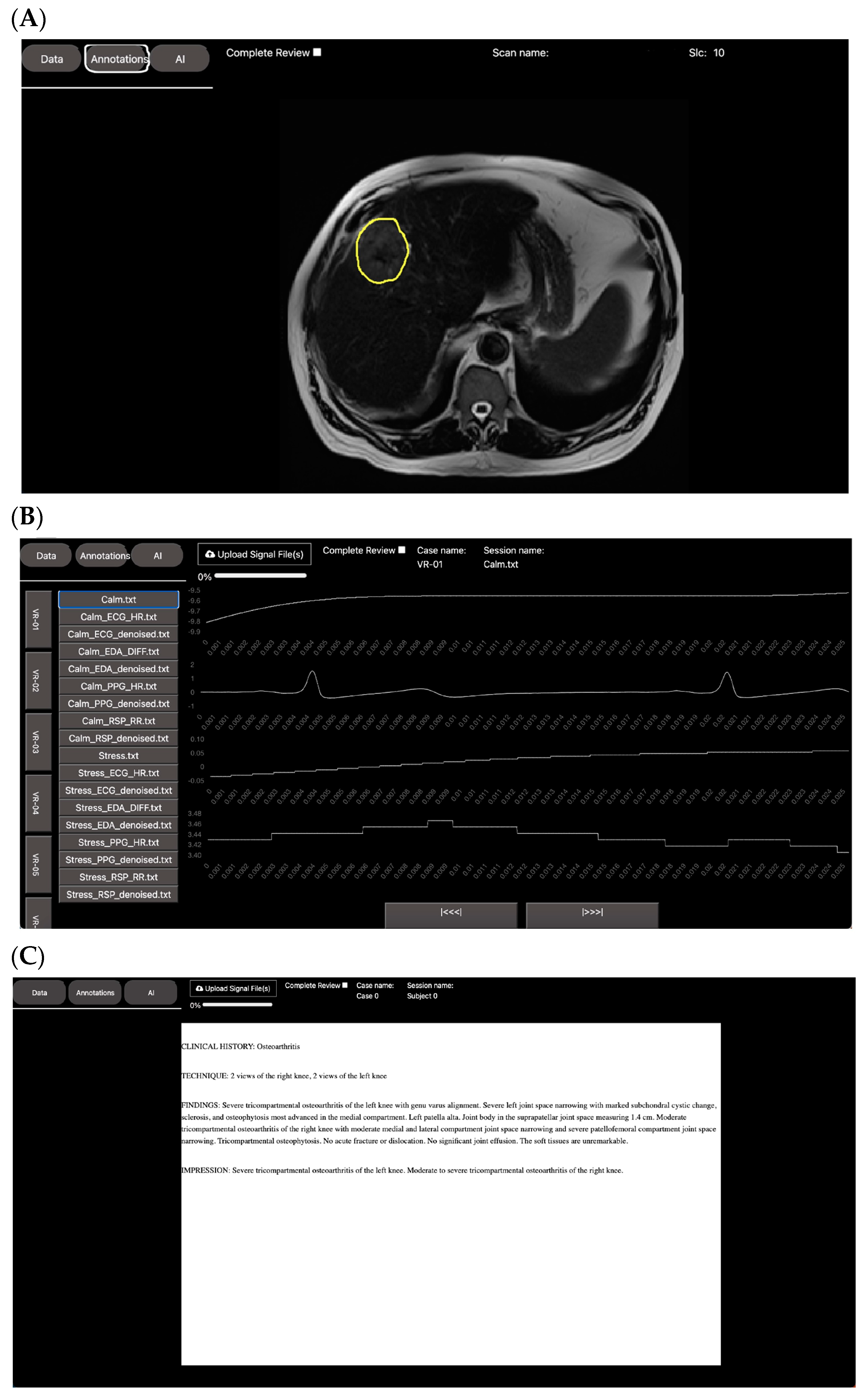 Bioengineering 10 01396 g007