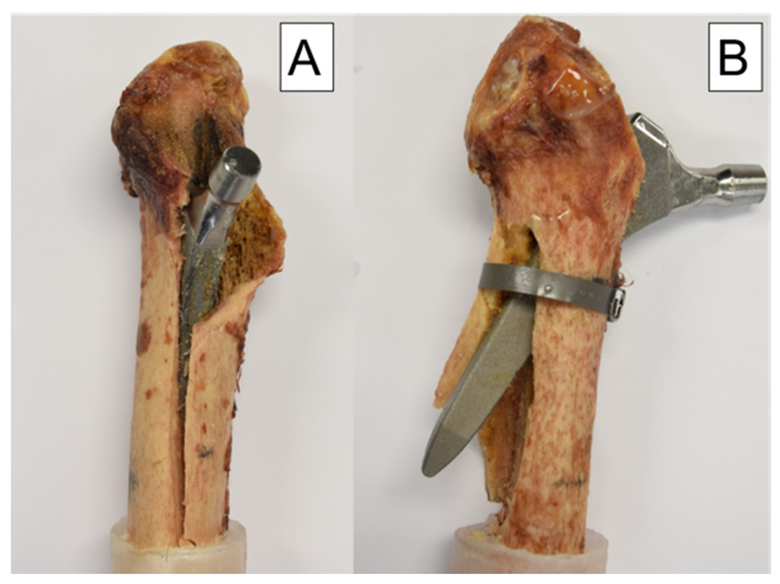 Bioengineering 10 01397 g007 Bioengineering 10 01397 g007