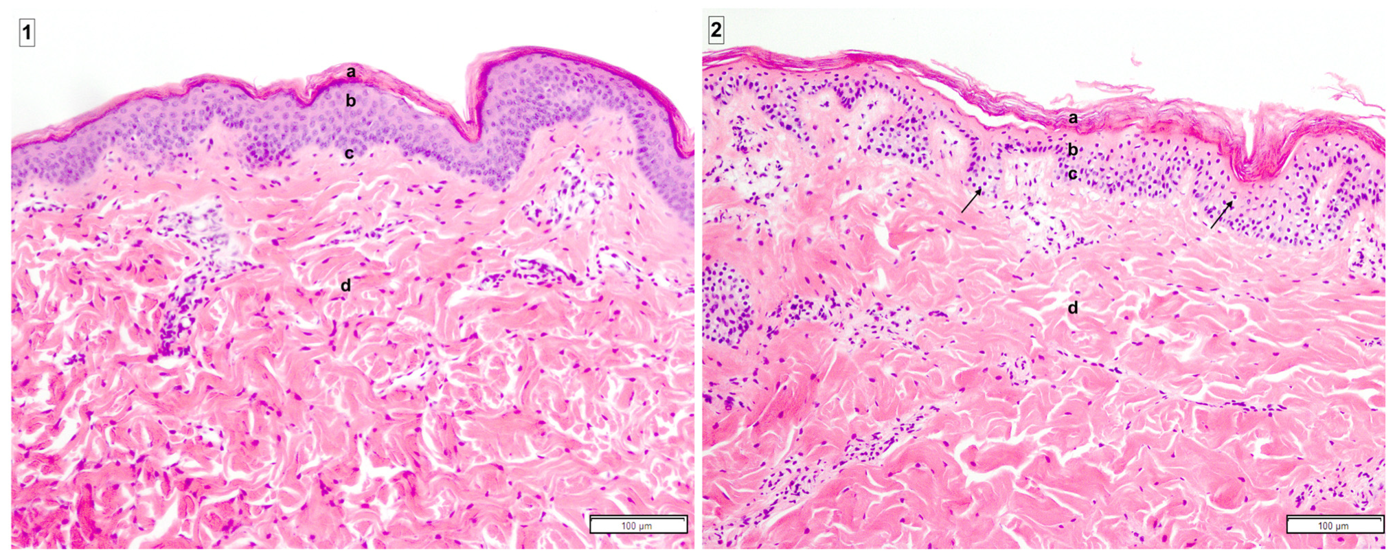 Bioengineering 10 01415 g0a2