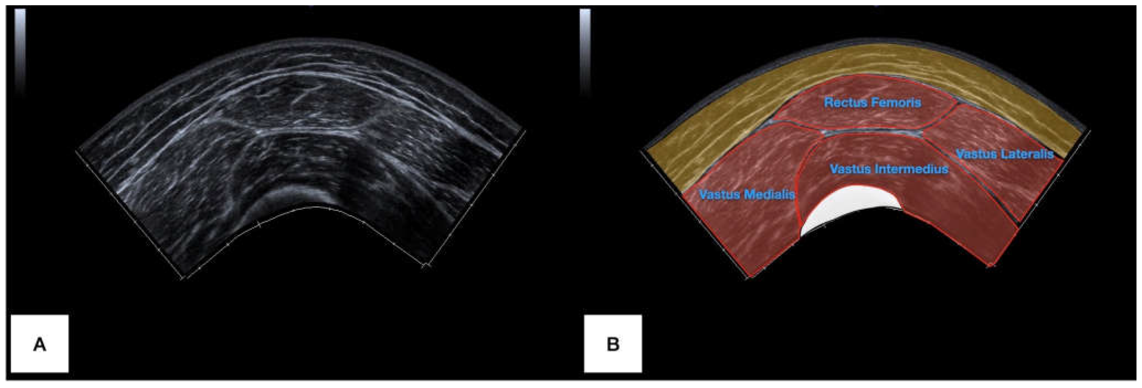 Bioengineering 11 00040 g002