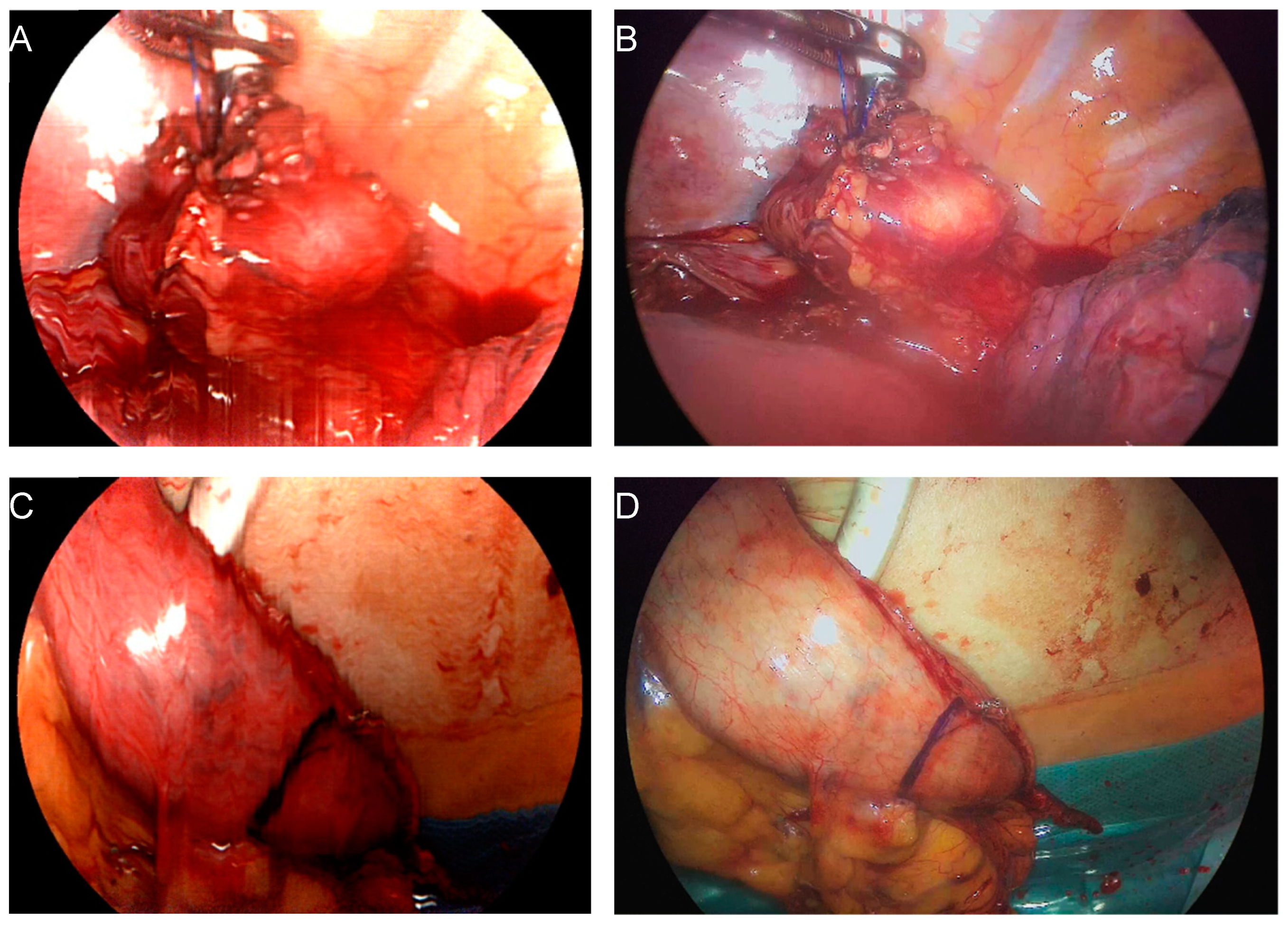 Bioengineering 11 00069 g001