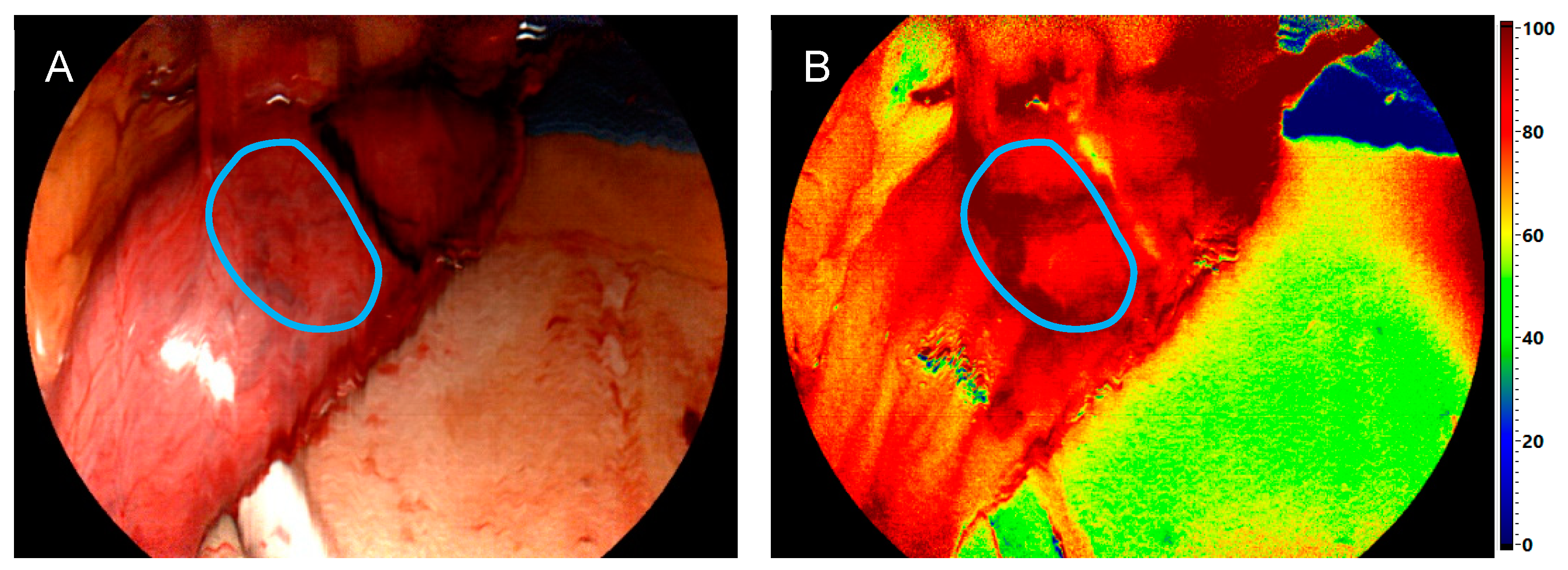 Bioengineering 11 00069 g003