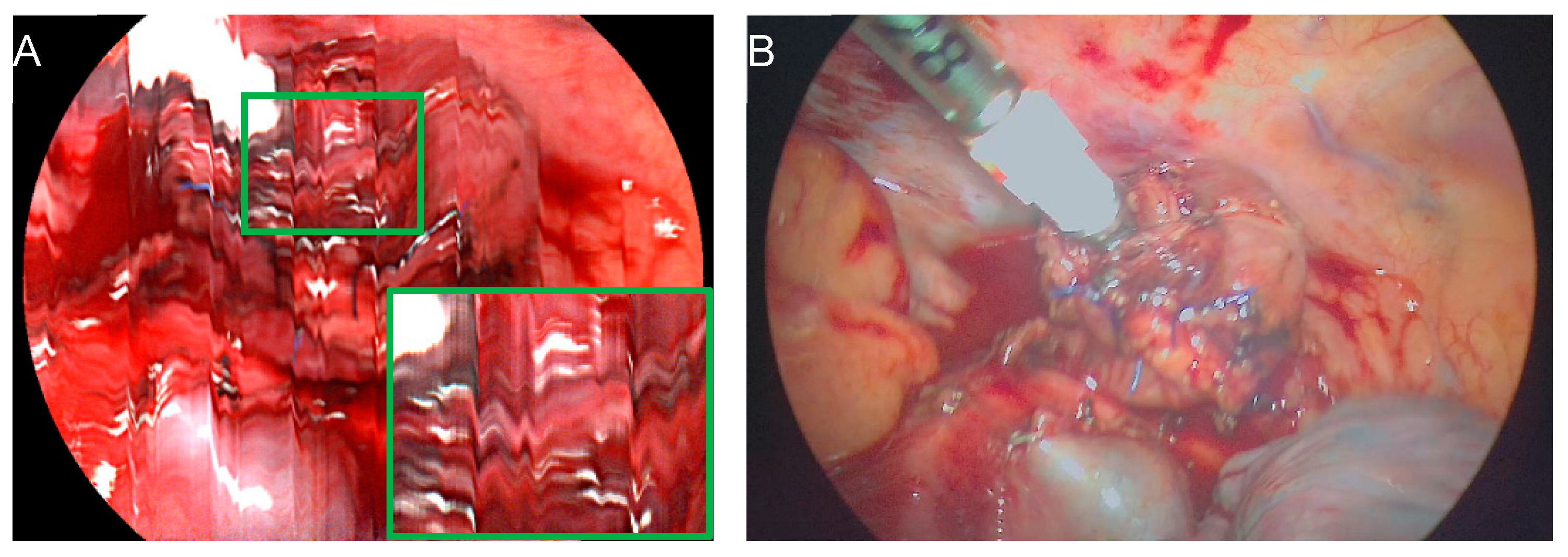 Bioengineering 11 00069 g004