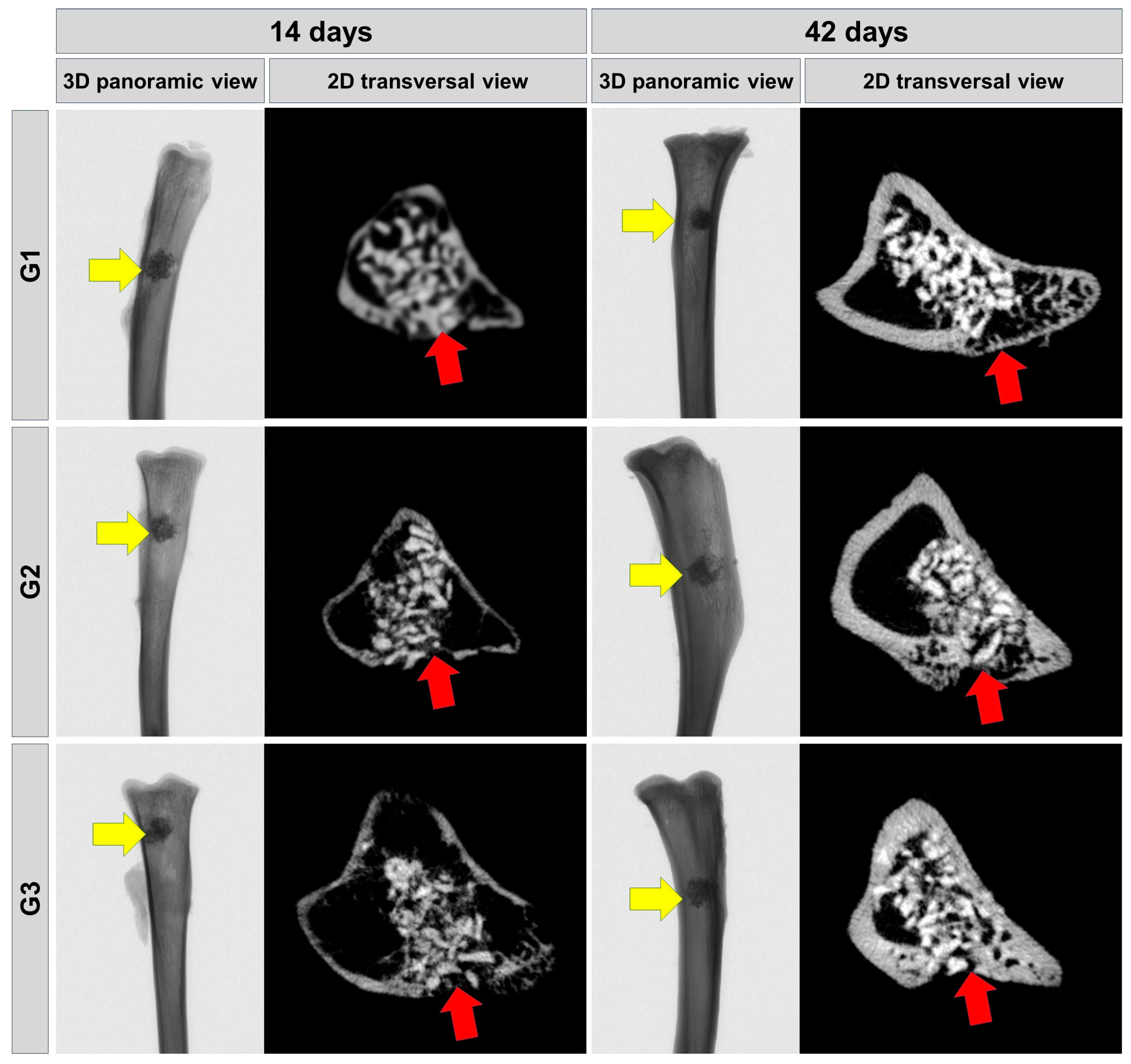Photobiomodulation Therapy Improves Repair of Bone Defects