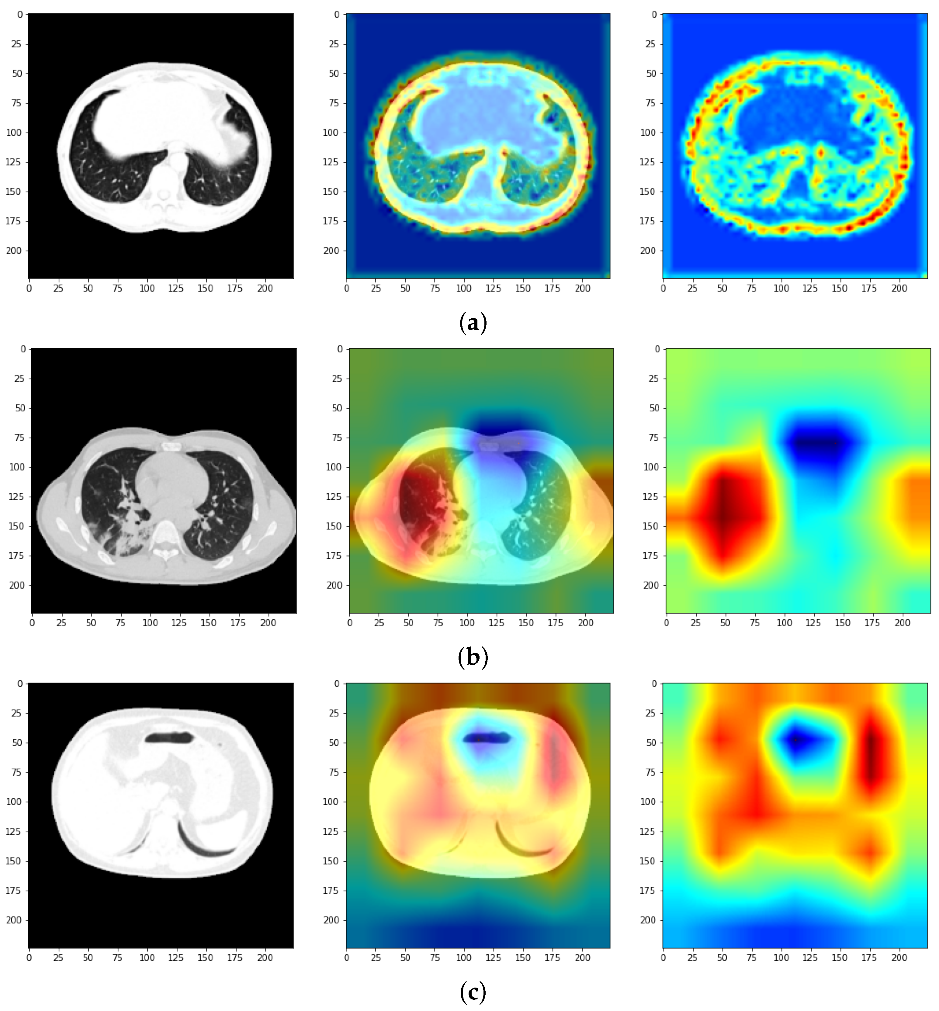 Bioengineering 11 00079 g012