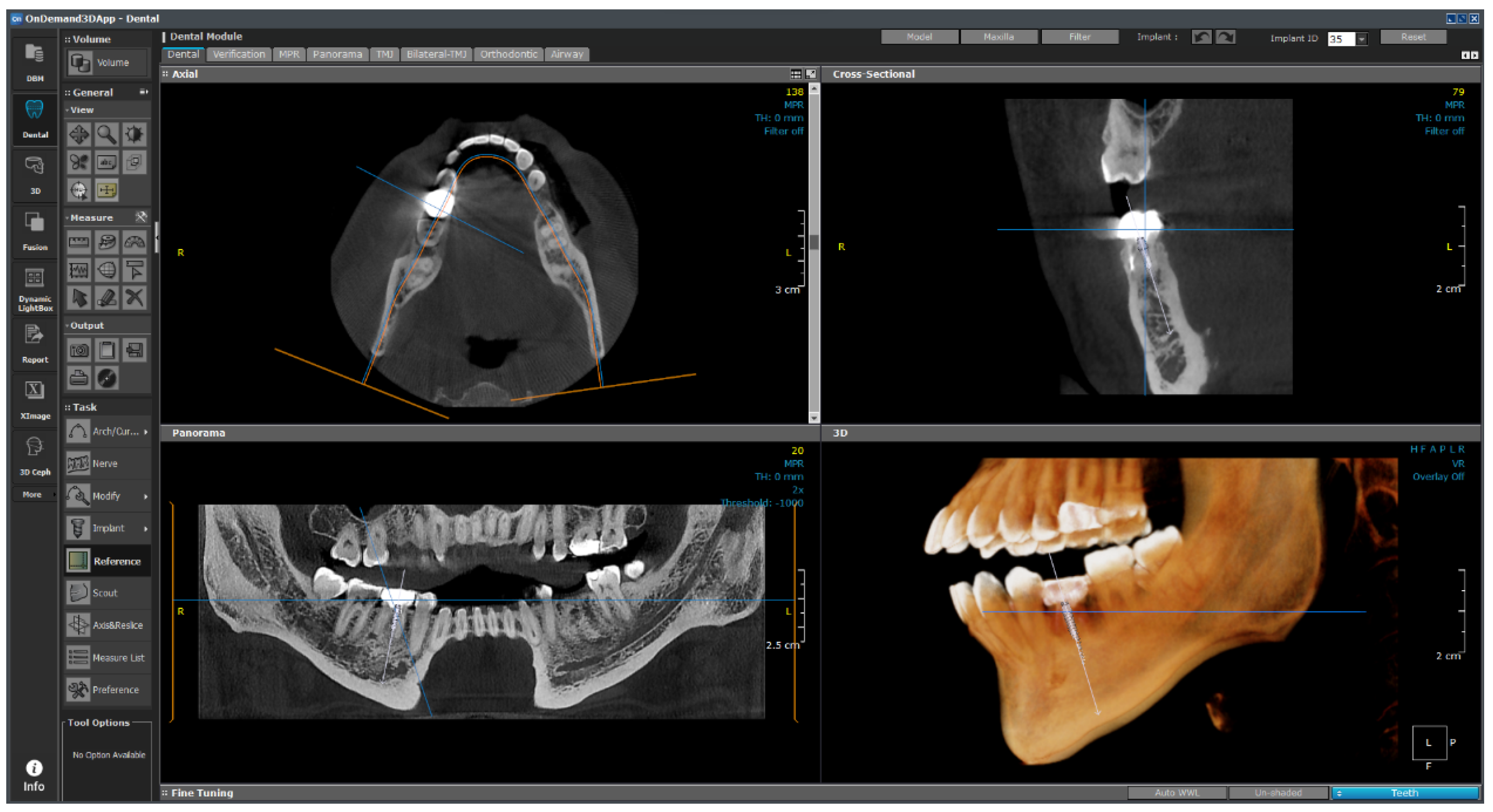 Bioengineering 11 00084 g024