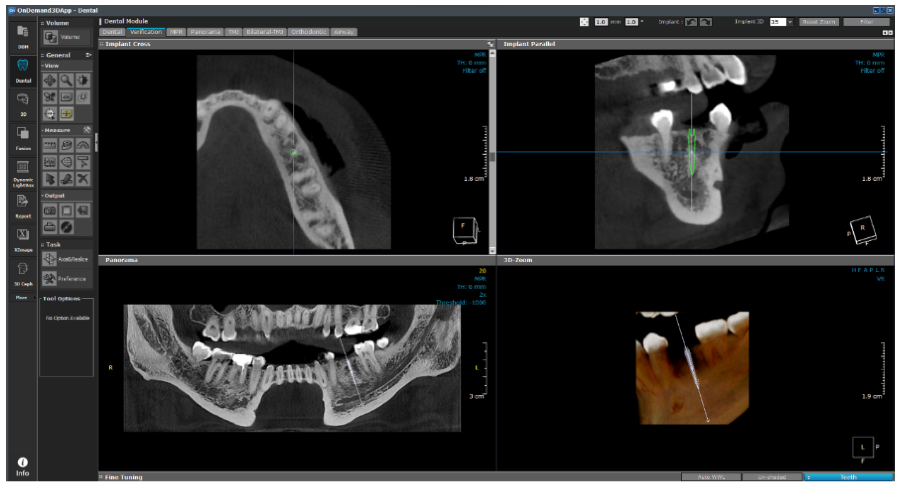 Bioengineering 11 00084 g027