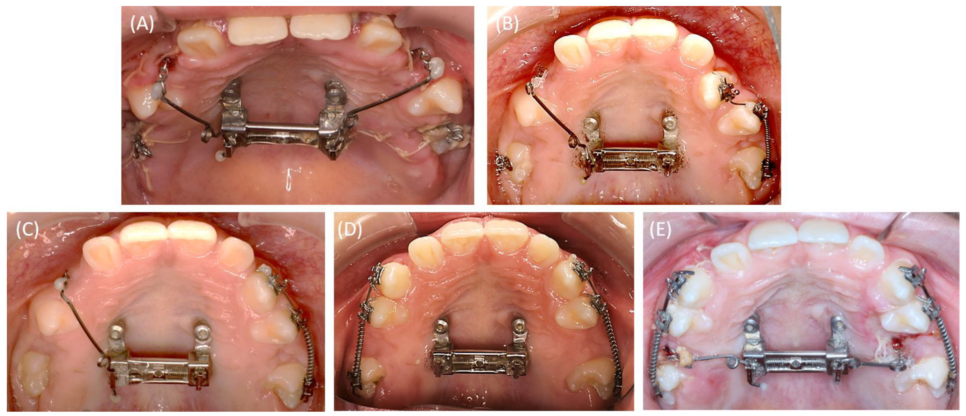 Bioengineering 11 00091 g006 Bioengineering 11 00091 g006