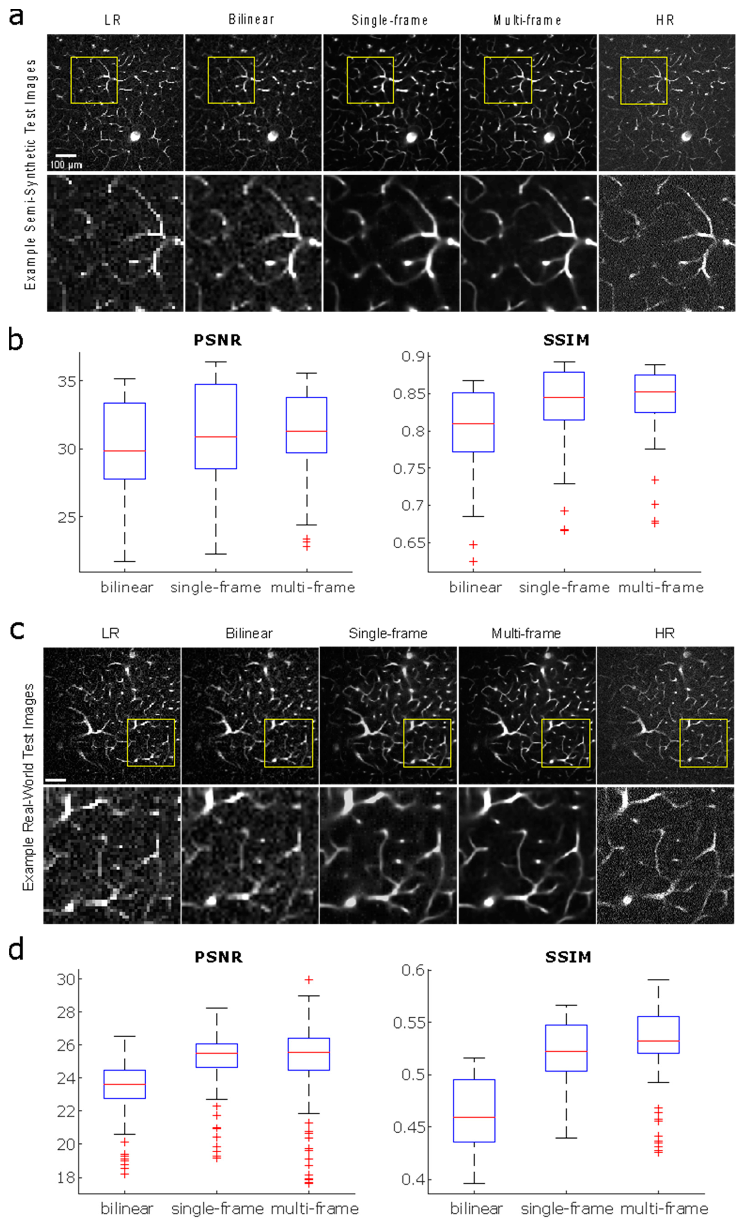 Bioengineering 11 00111 g003
