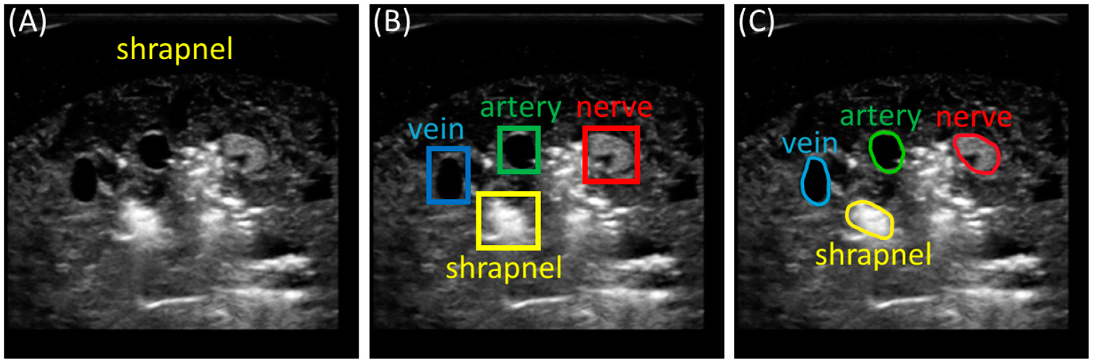 Bioengineering 11 00128 g001