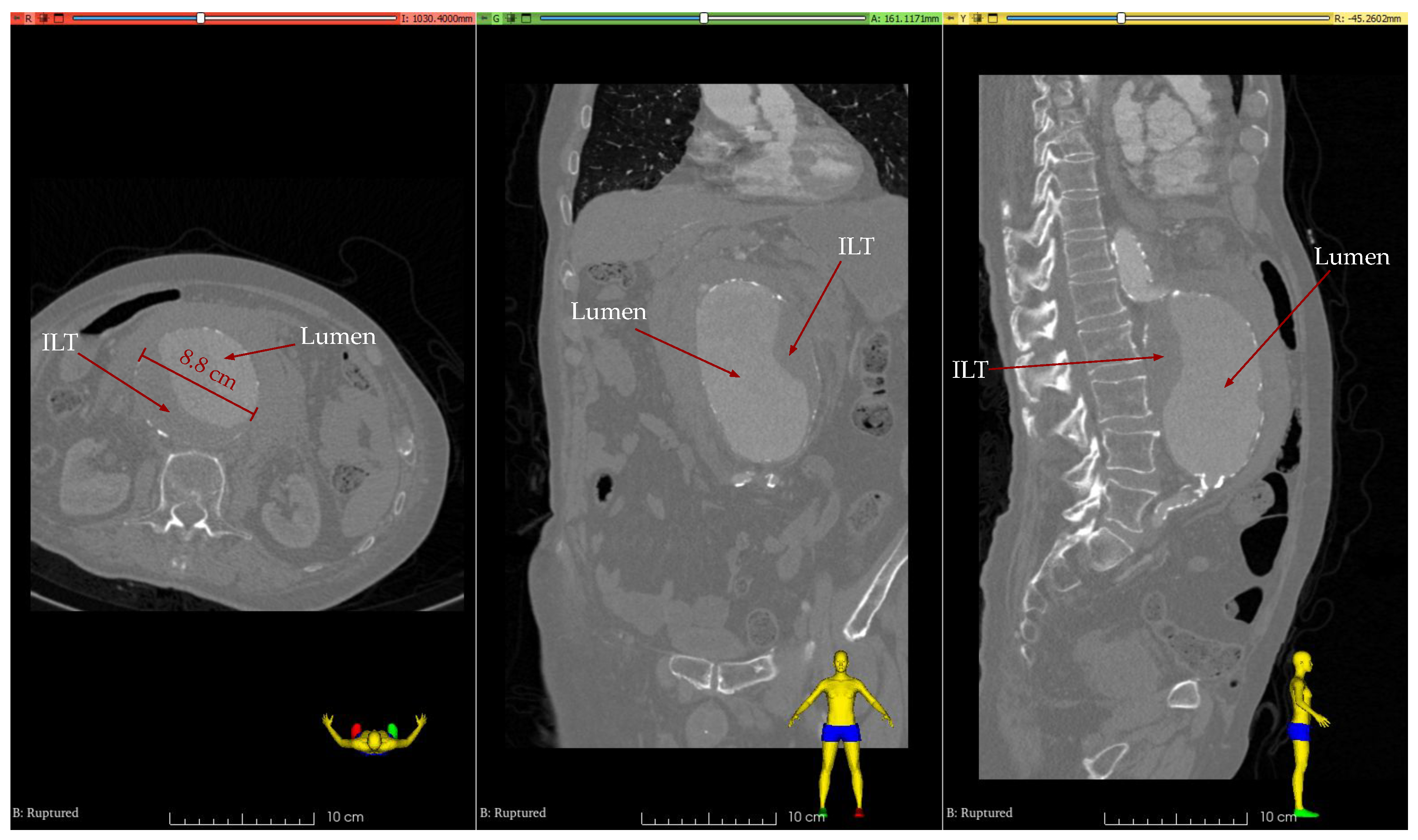 Bioengineering 11 00144 g001
