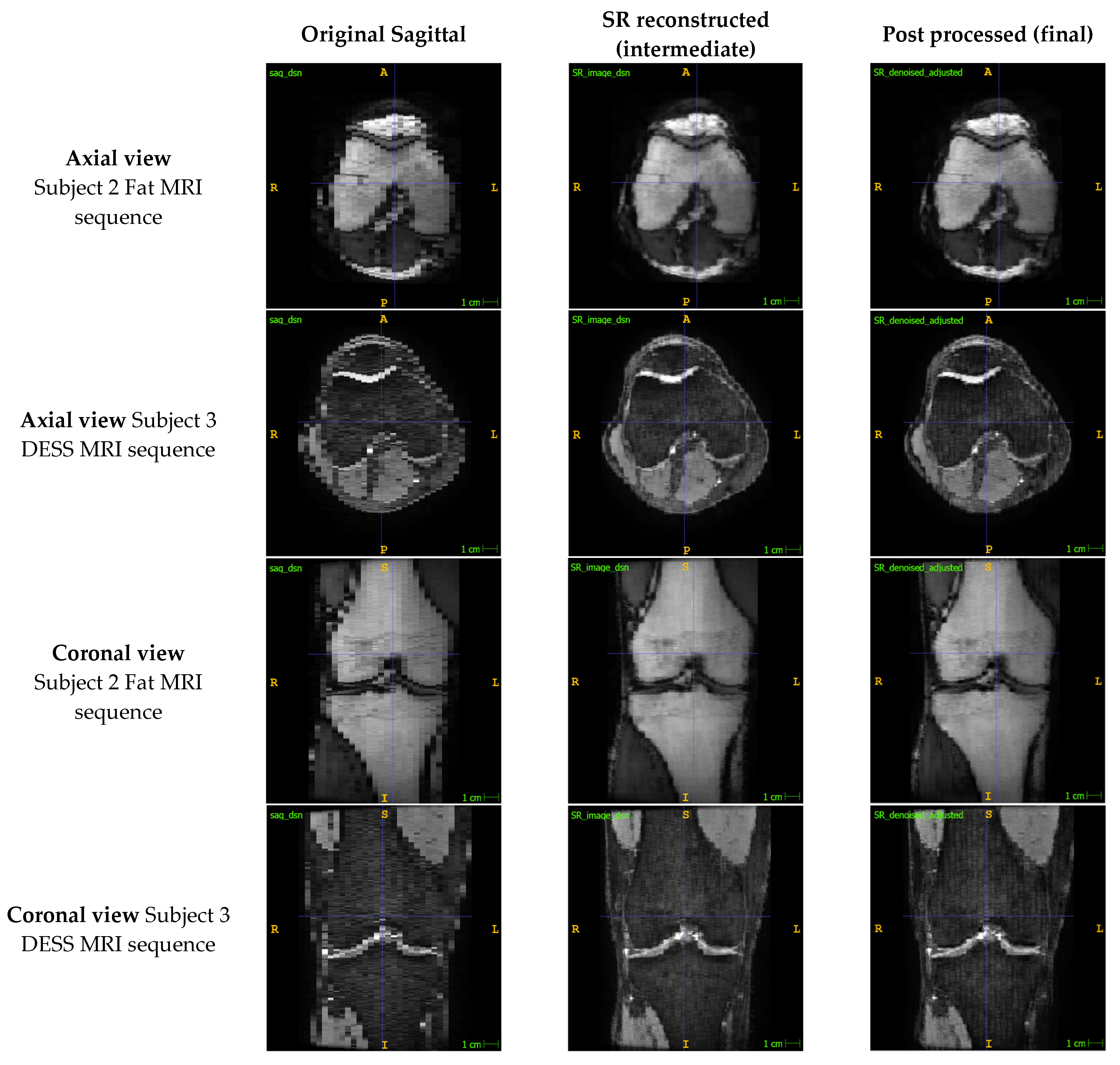 Bioengineering 11 00186 g003