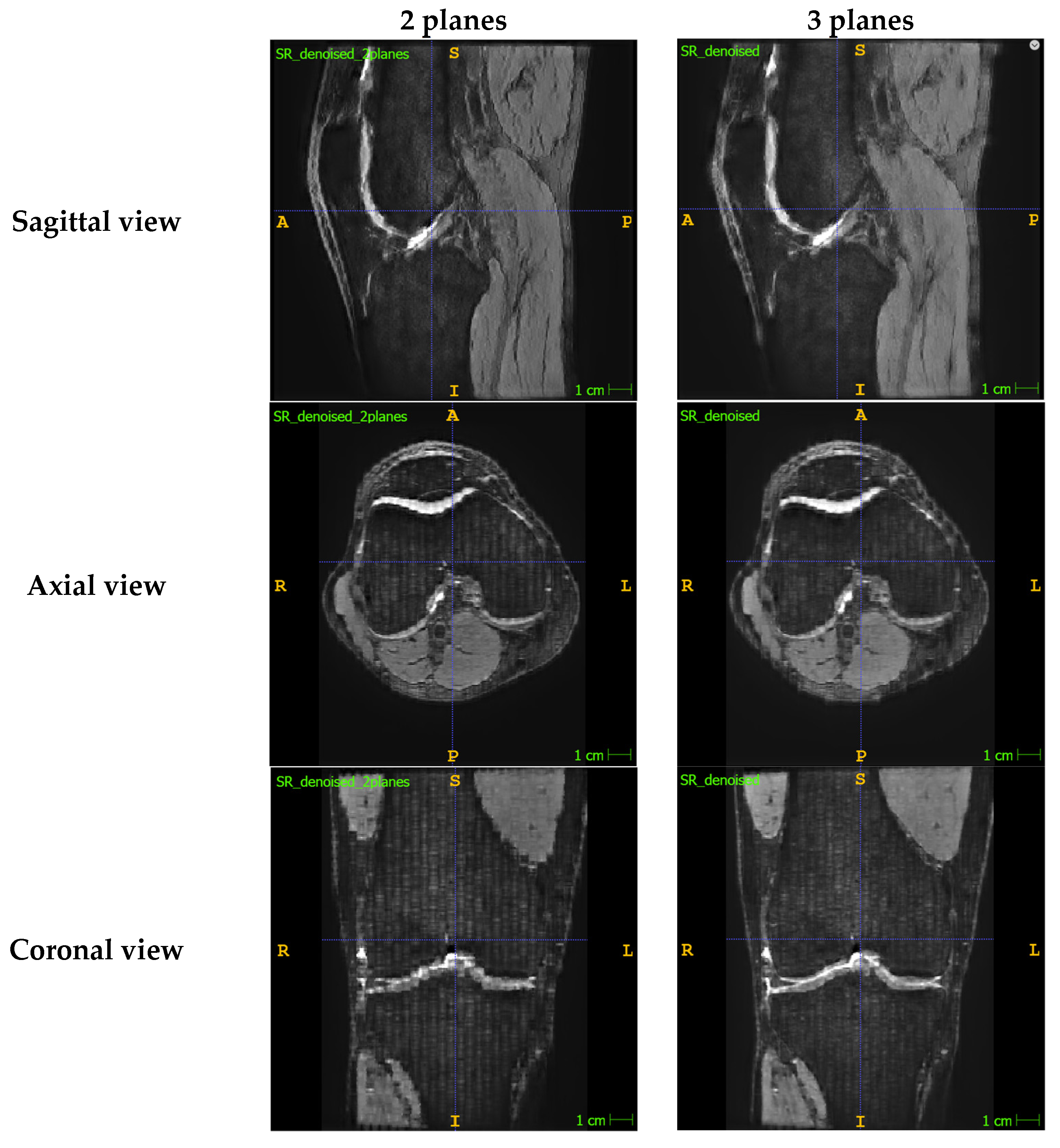 Bioengineering 11 00186 g0a1