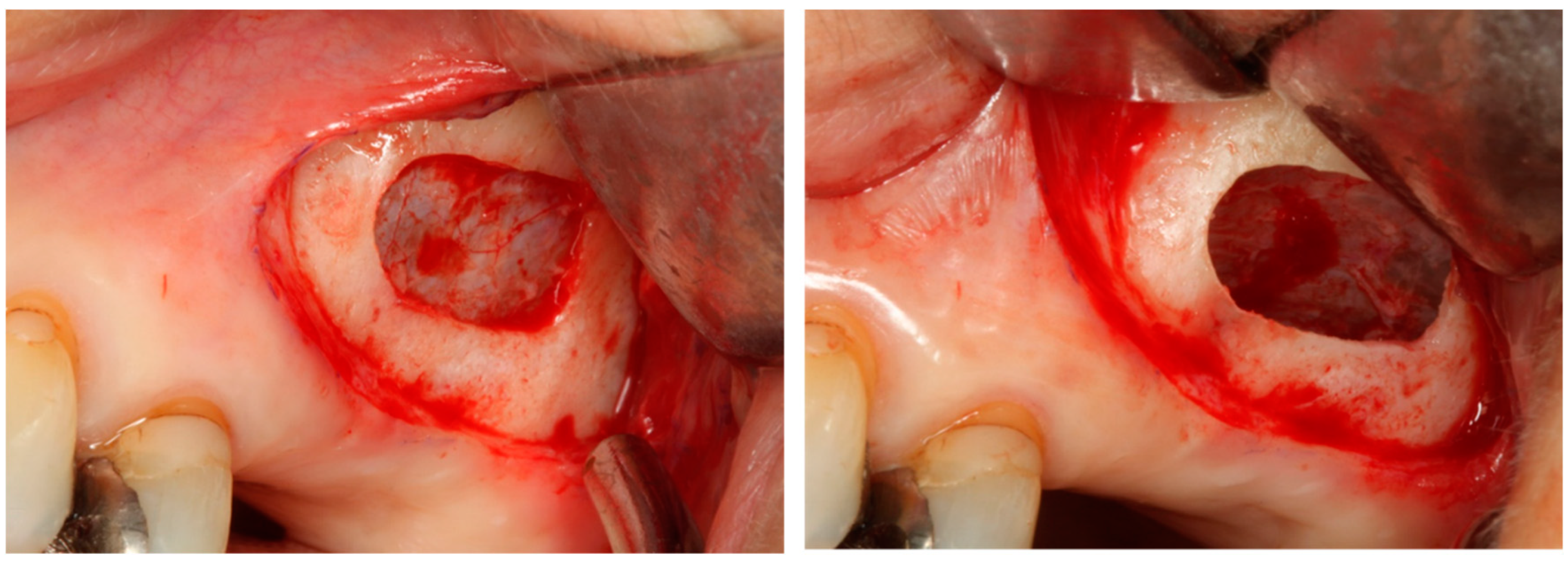 Bioengineering 11 00192 g004