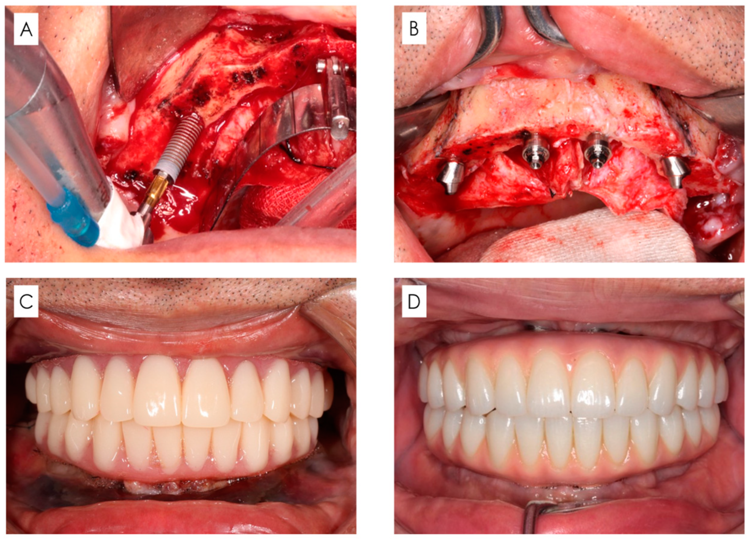 Bioengineering 11 00223 g002