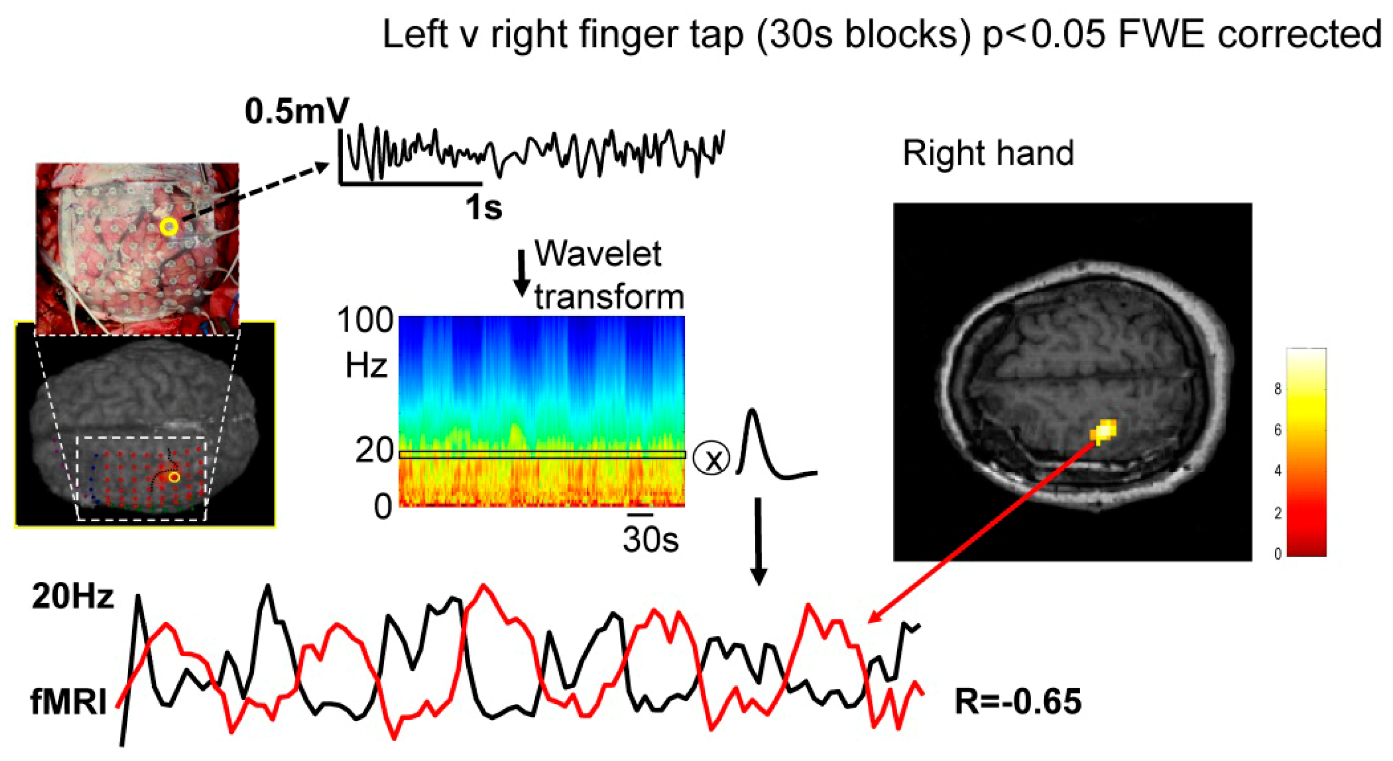 brain-products-xon-eeg-headset