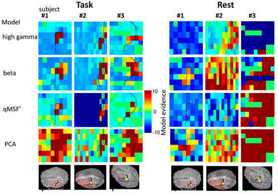 Measurement of the Mapping between Intracranial EEG and fMRI Recordings ...