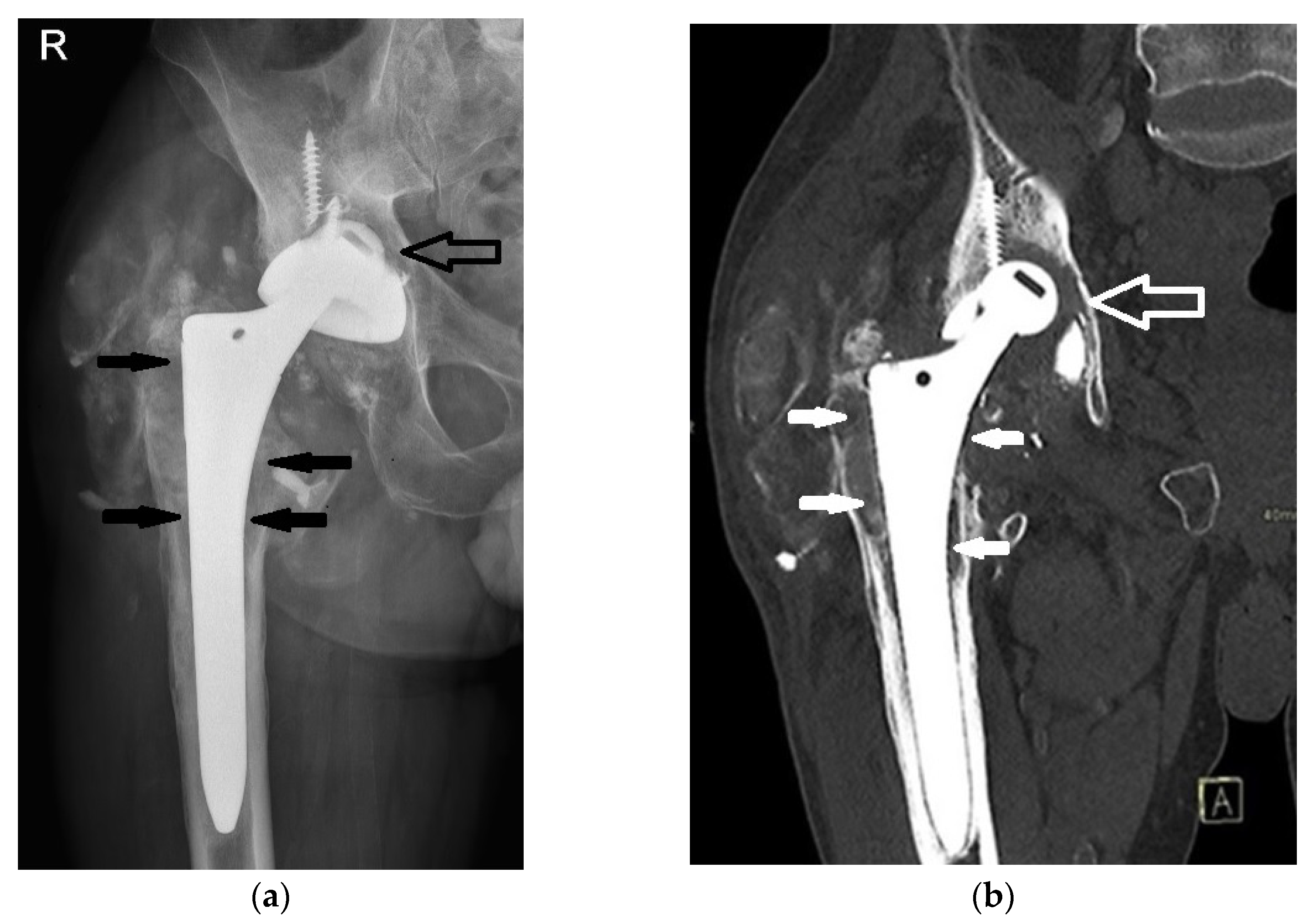 Bioengineering 11 00235 g002