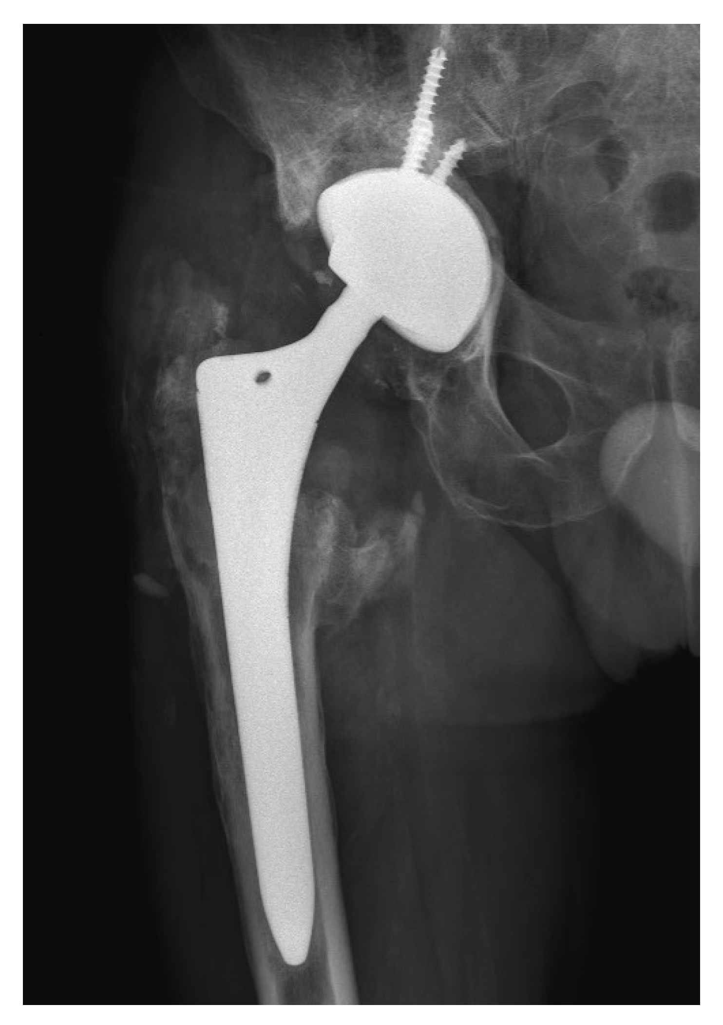 Bioengineering 11 00235 g005