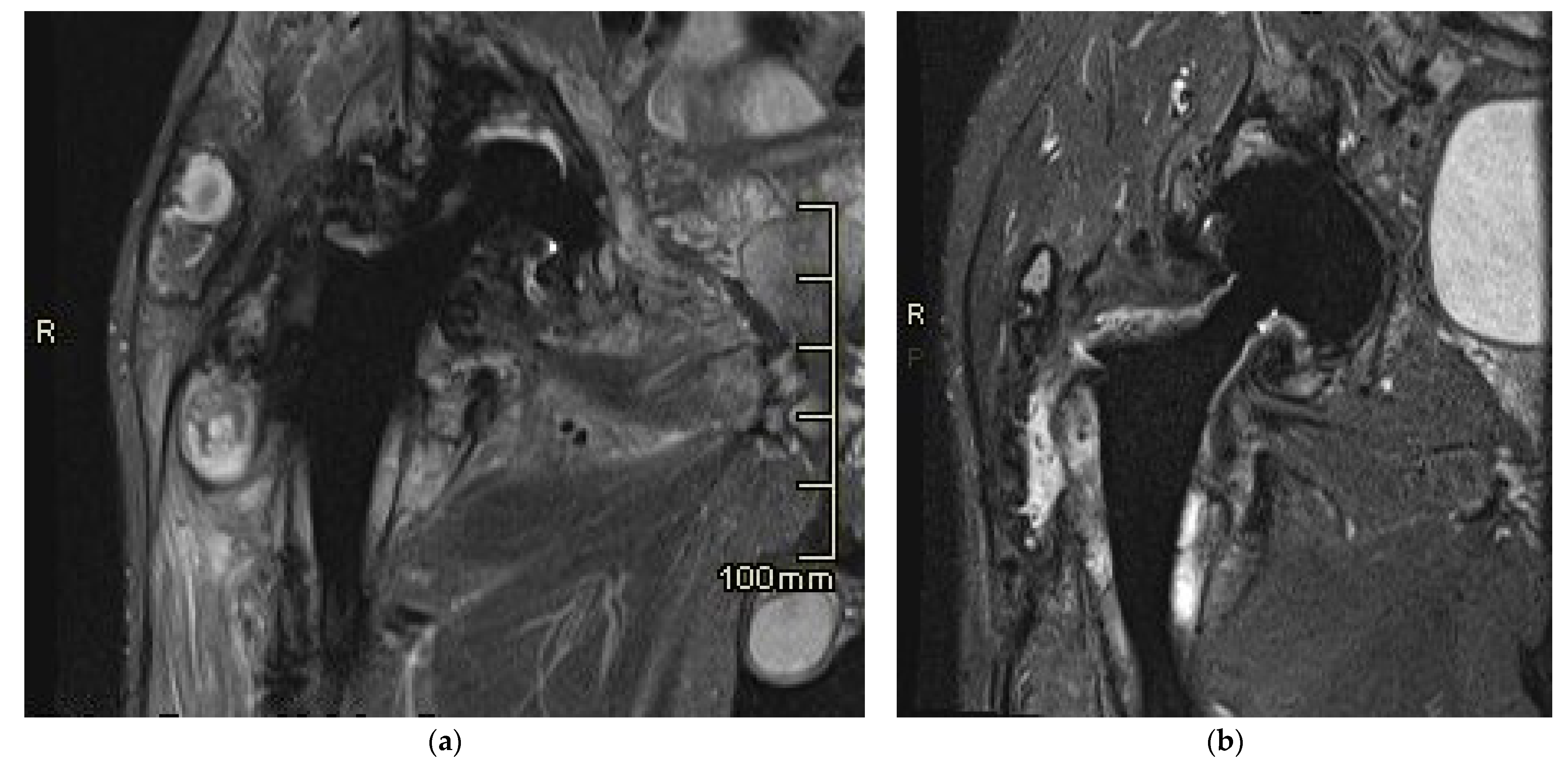 Bioengineering 11 00235 g007