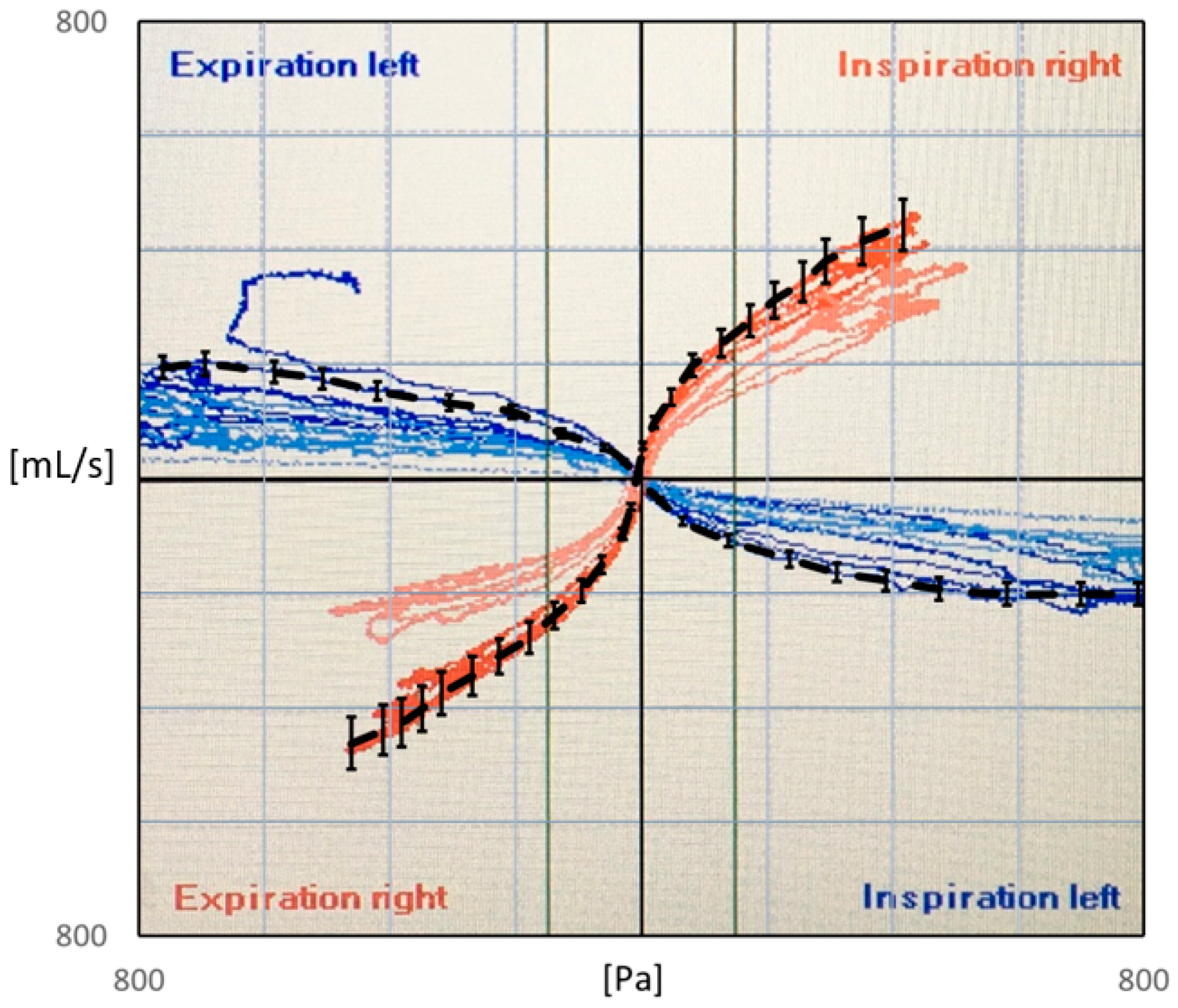 Computational Rhinology: Unraveling Discrepancies between In 