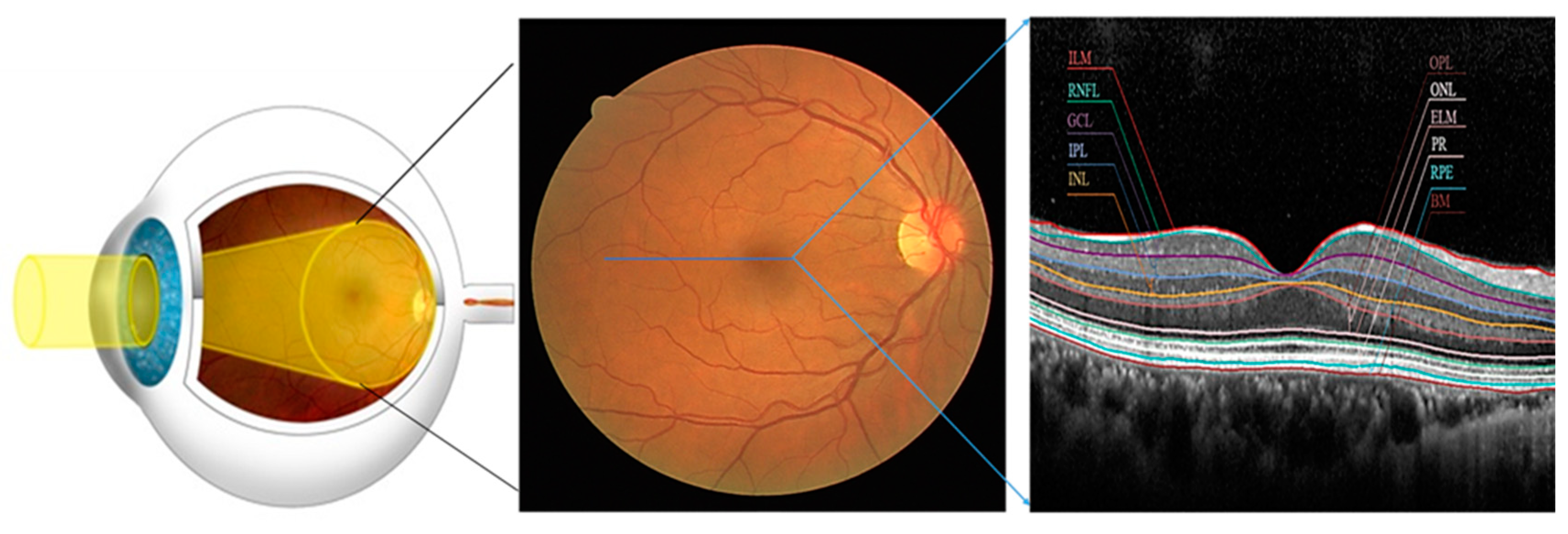 Bioengineering 11 00240 g001