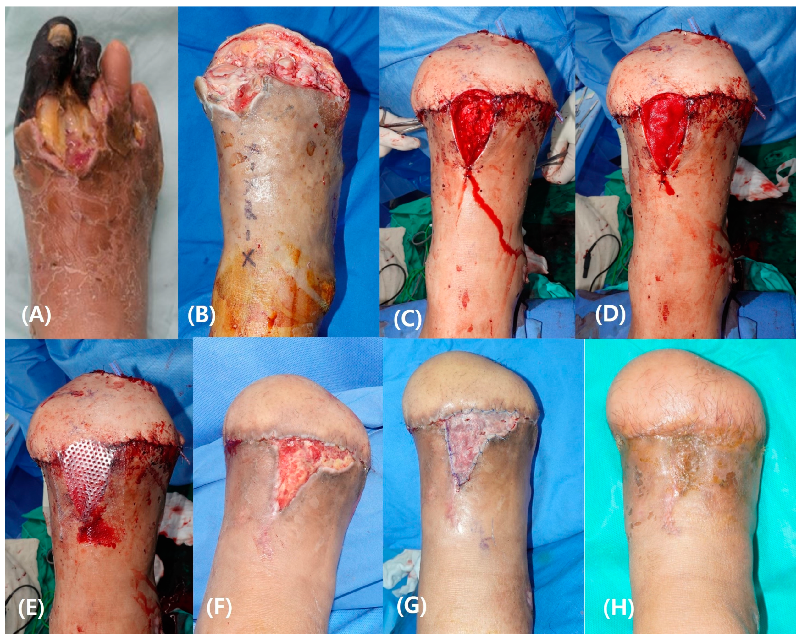 Bioengineering 11 00241 g005