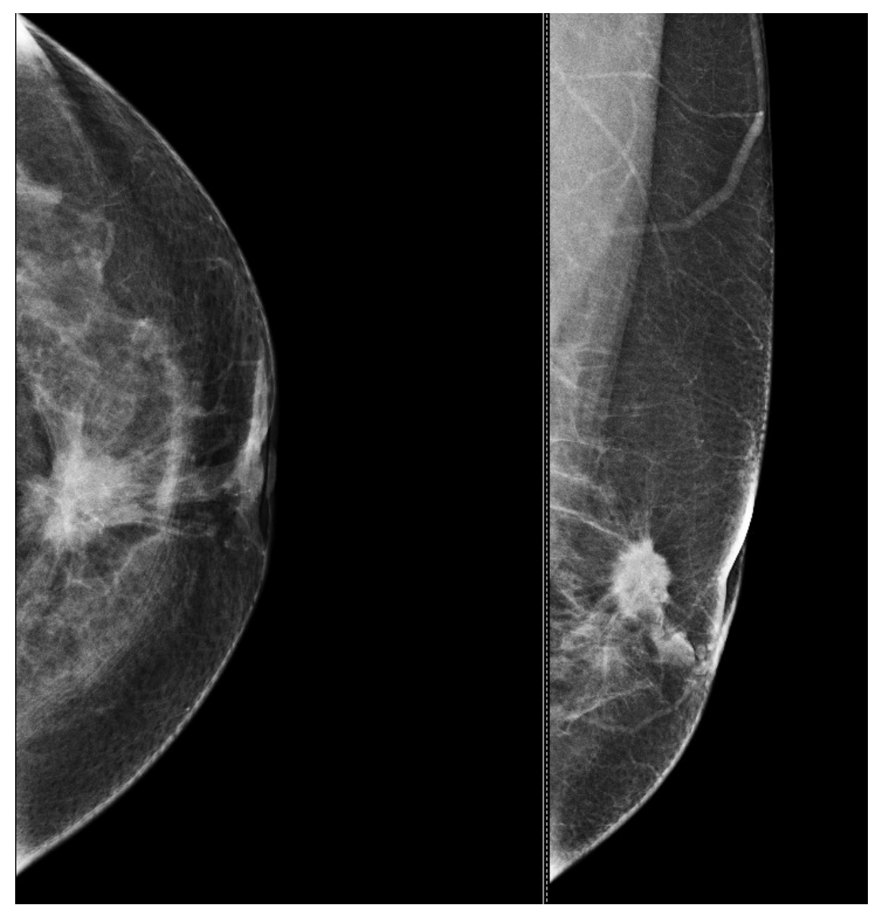 Bioengineering 11 00262 g004