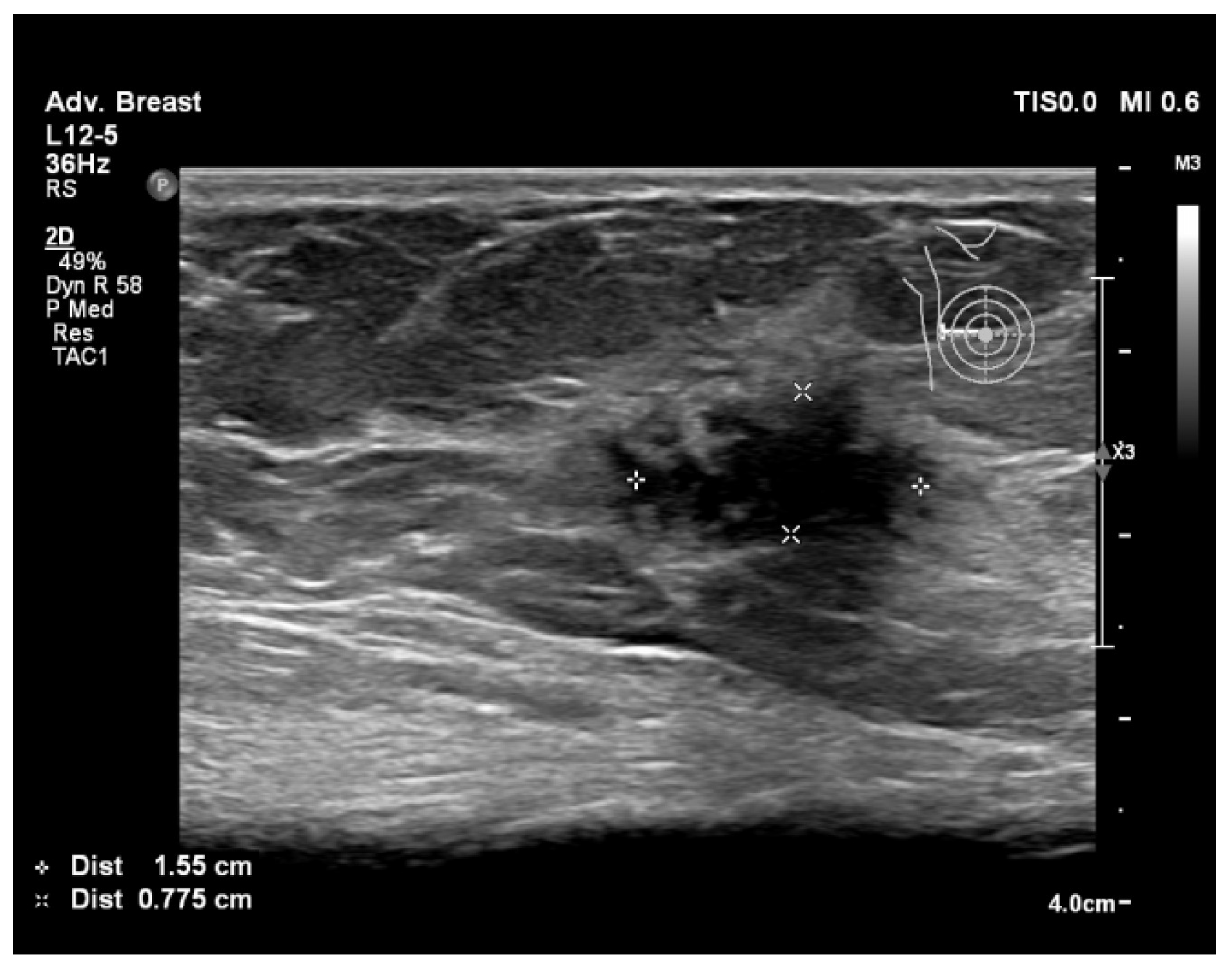 Bioengineering 11 00262 g005