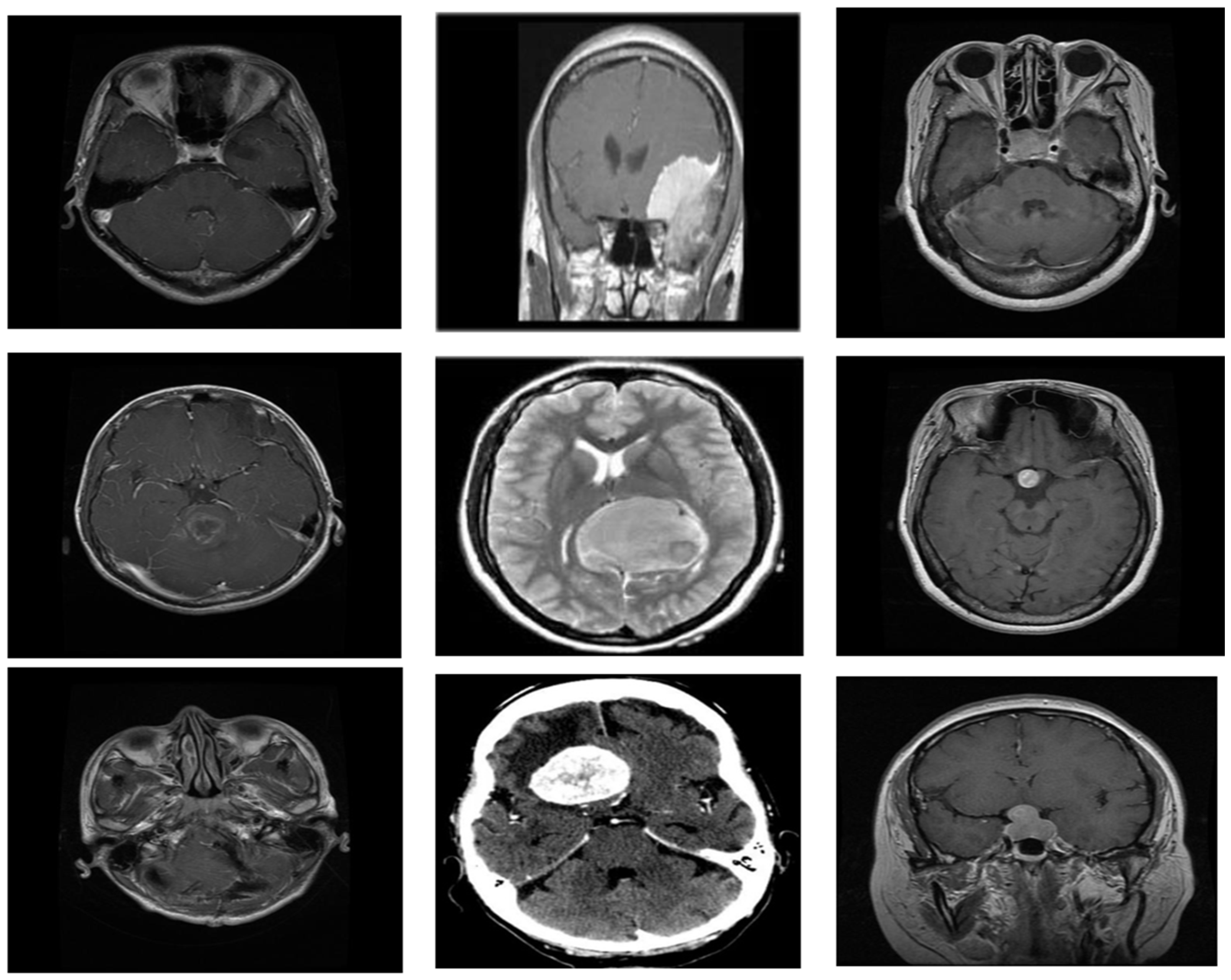 Bioengineering 11 00266 g002