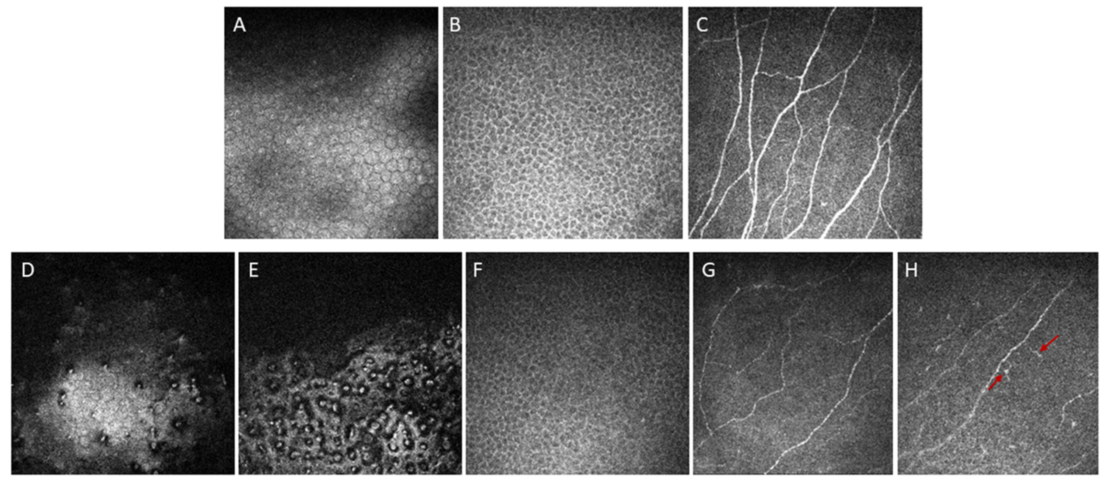 Bioengineering 11 00271 g005