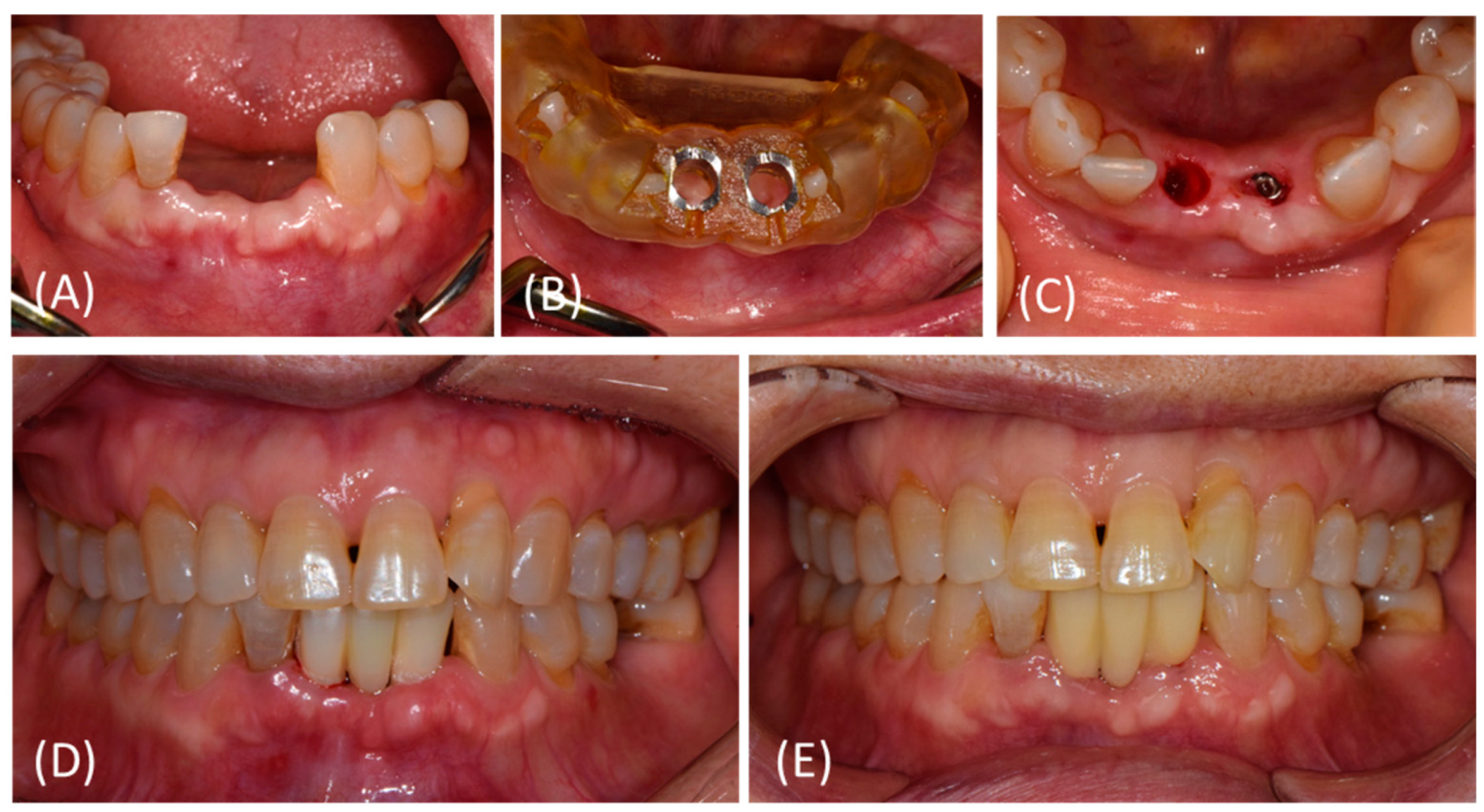 Bioengineering 11 00272 g002
